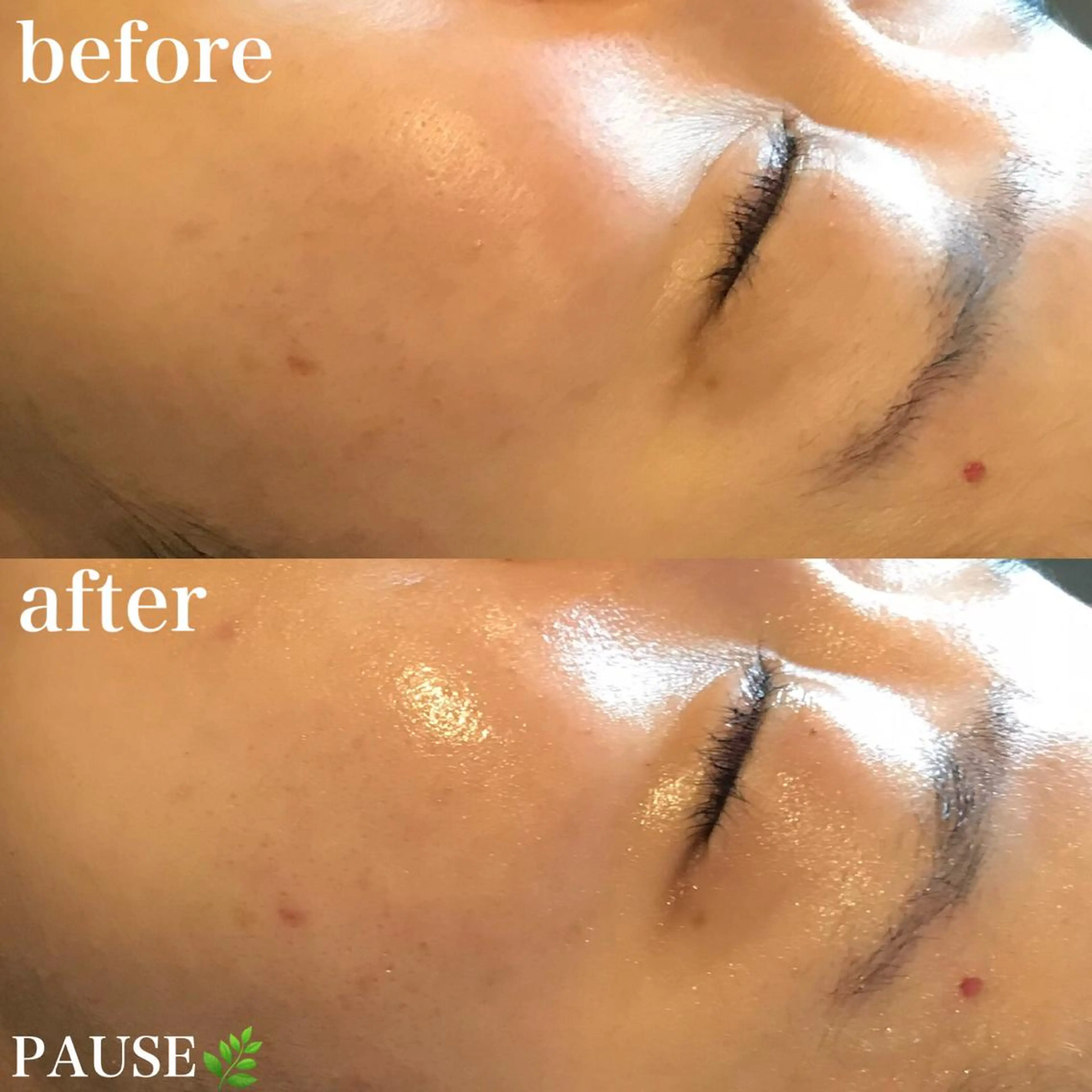 エステ 浜野 恵美のエステ・リラクイメージ