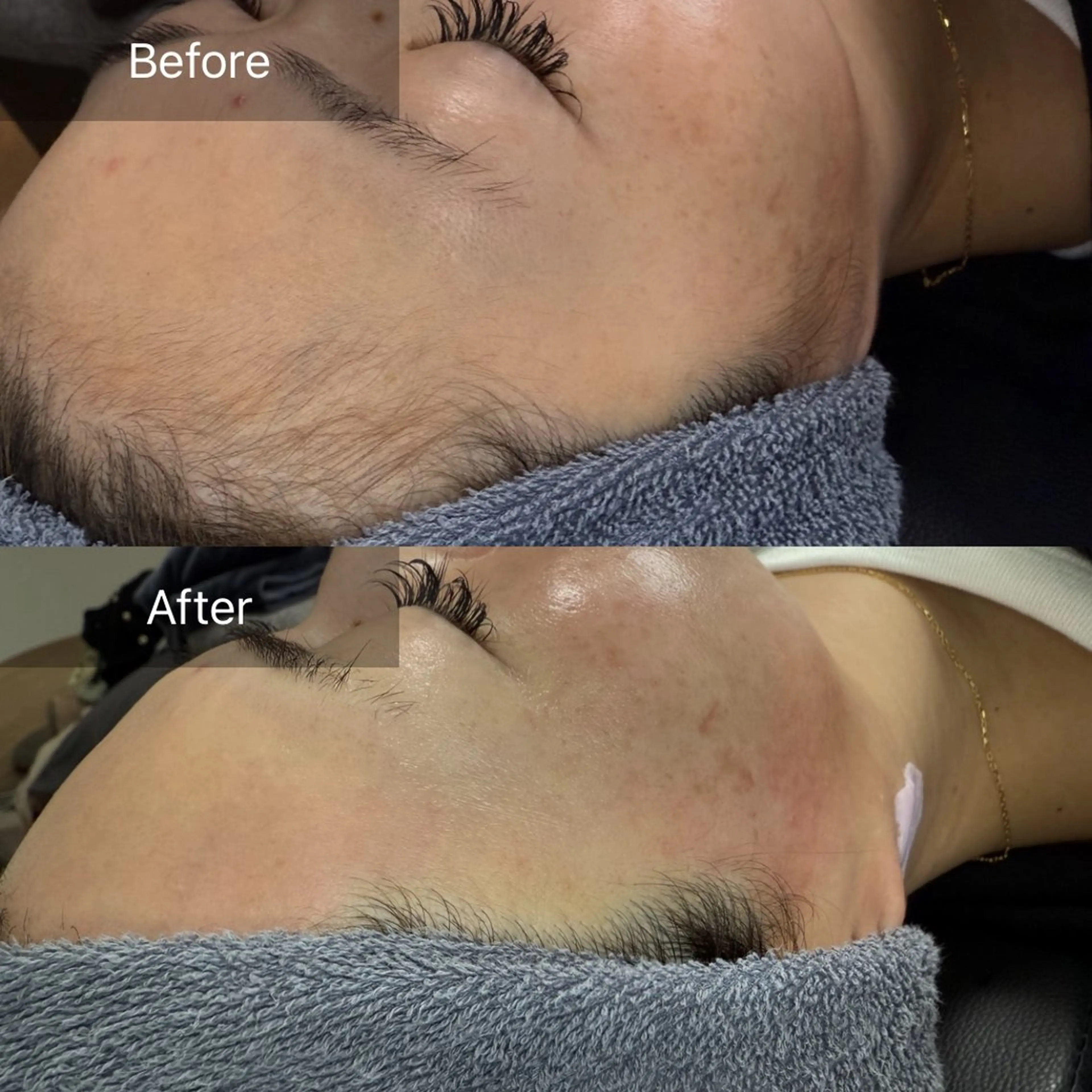 脱毛 enine フェイスWAXのエステ・リラクイメージ