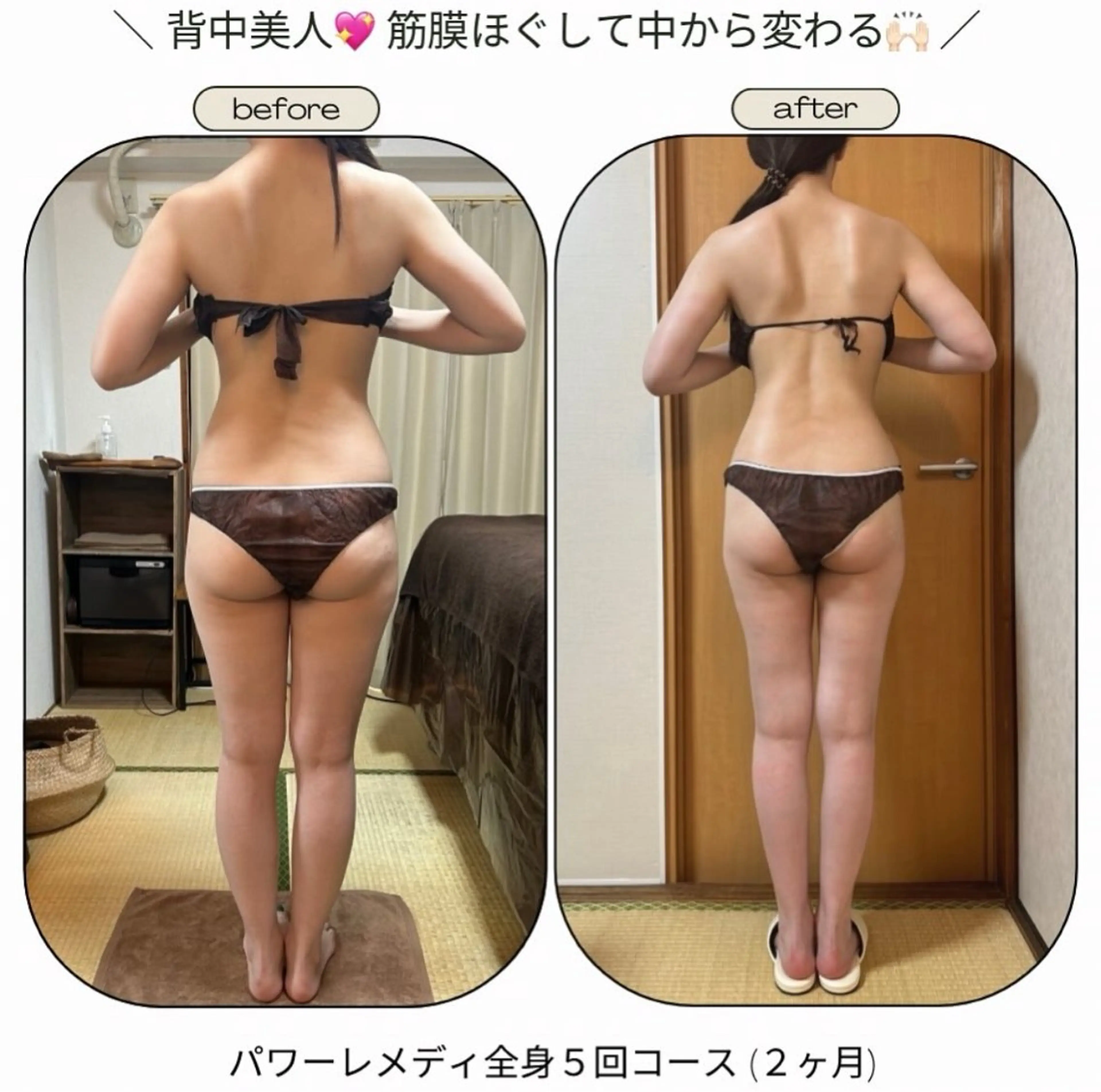 エステ リラク 《本気痩せ×疲労改善 》  BILOOPのエステ・リラクイメージ