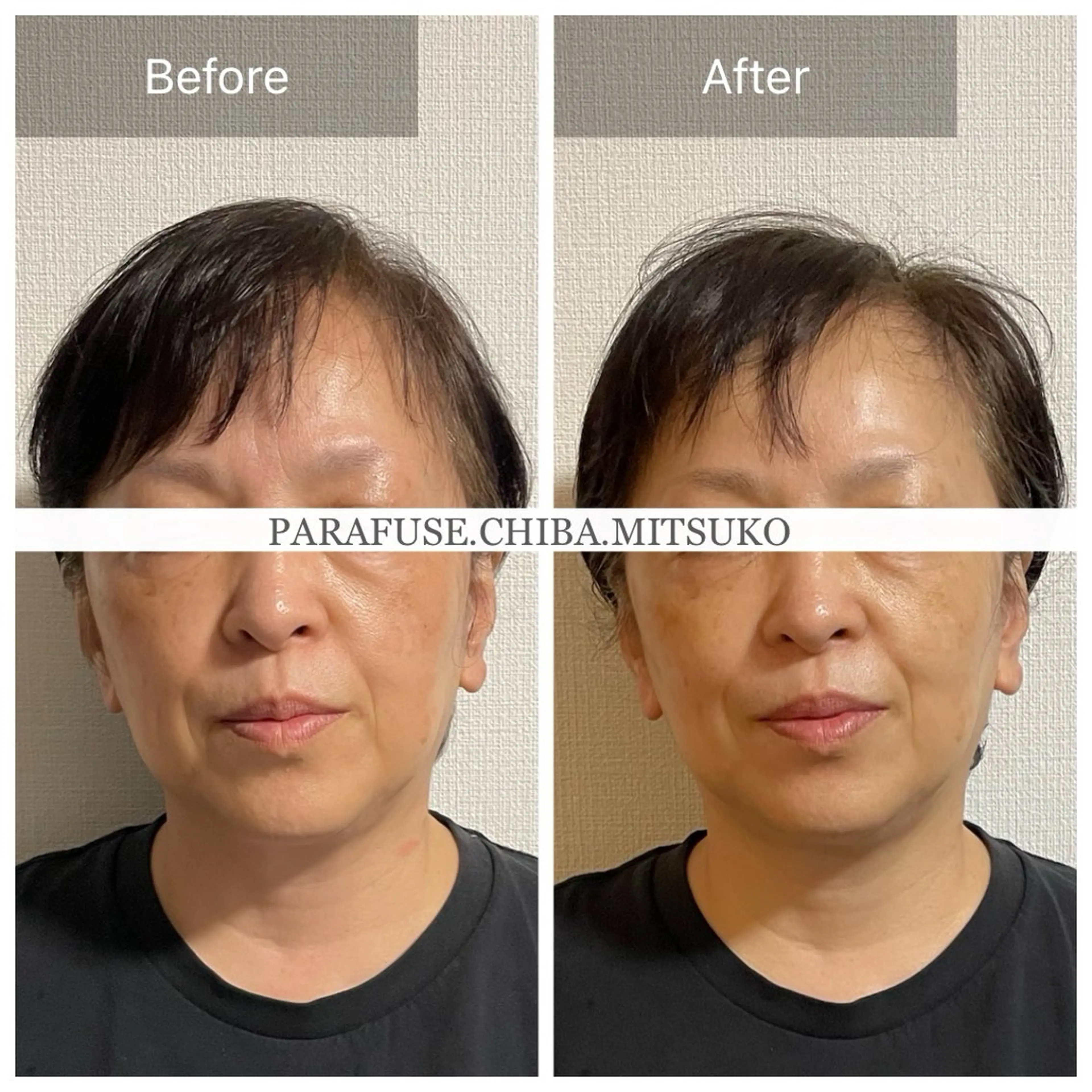 脳洗浄✳︎マツヤニ/ みつこのエステ・リラクイメージ