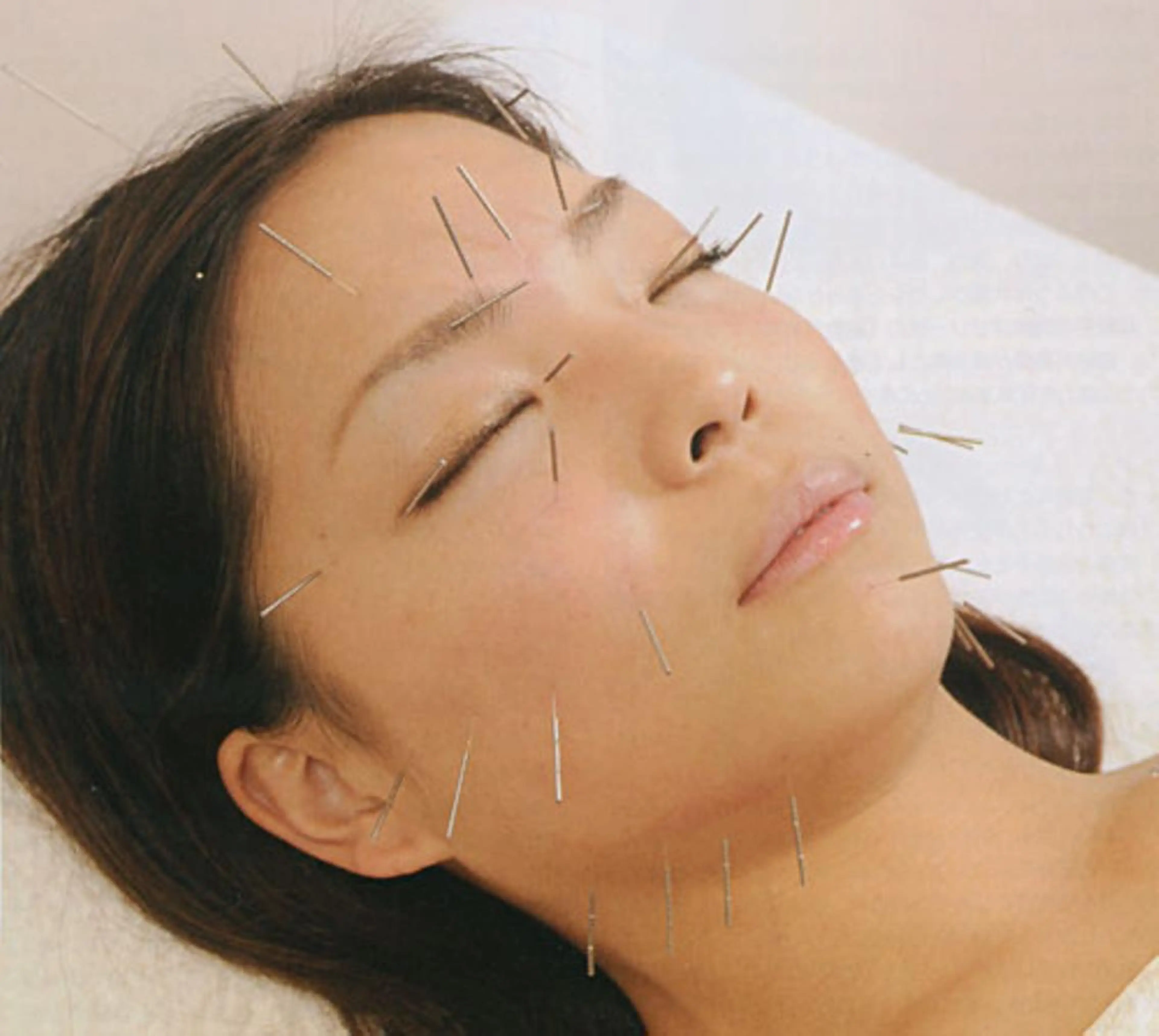 エステ リラク 同心整骨院 美容鍼・整体・小顔のエステ・リラクイメージ