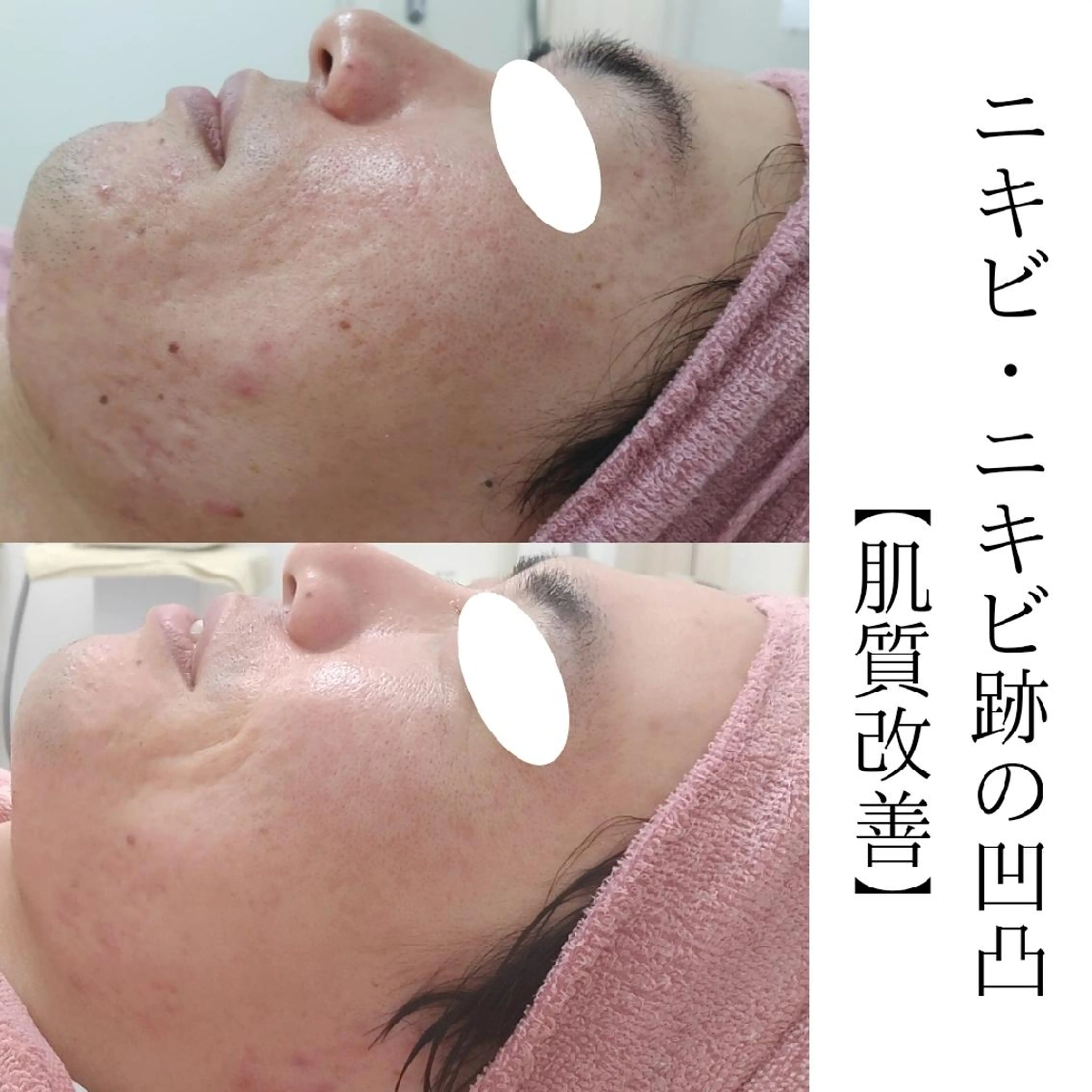 ユニセックスエステサロンUniclear所属・佐賀痩身エステ/小顔 @uni.clearのエステ・リラクイメージ