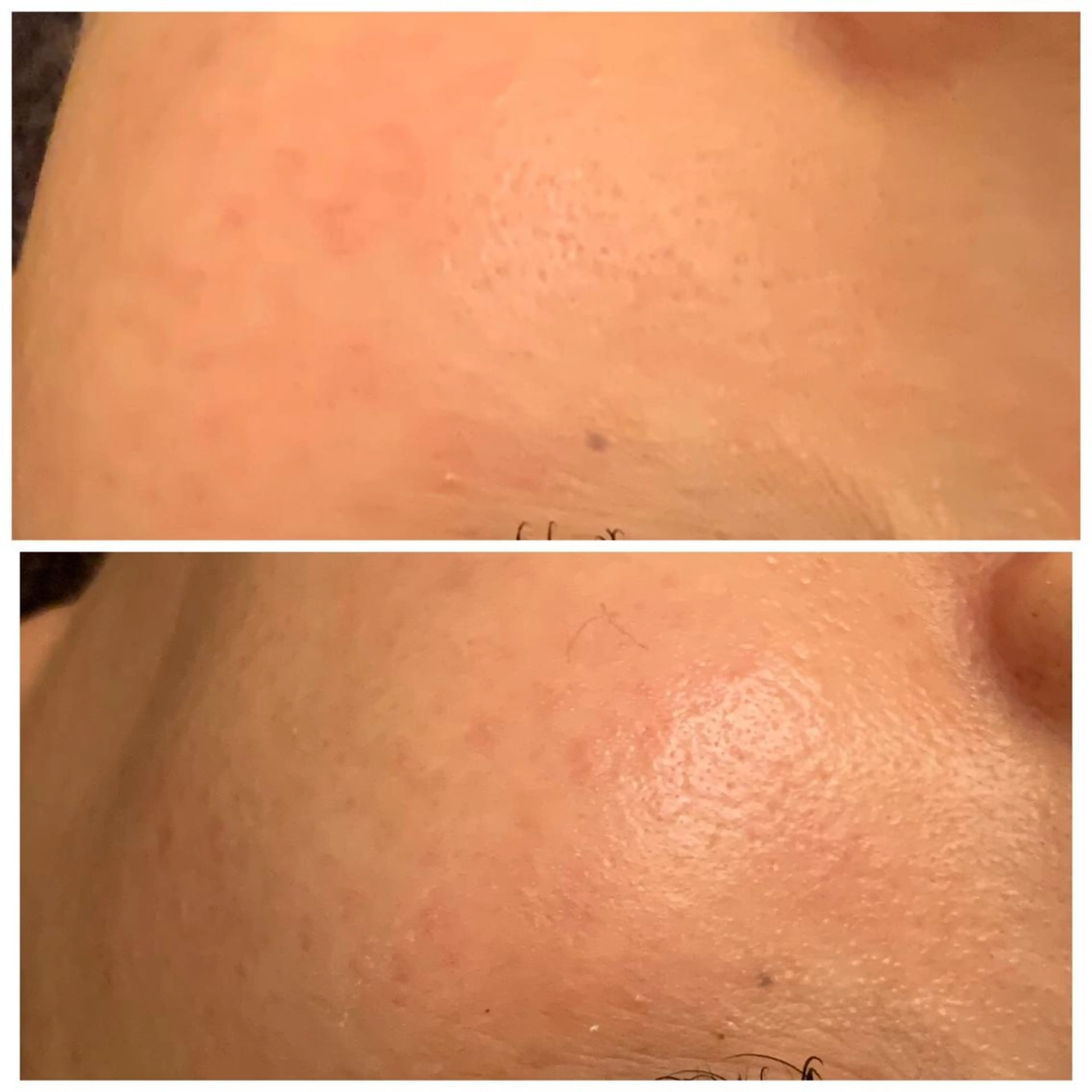 食べながら魅せボディ éclatJua川越のエステ・リラクイメージ