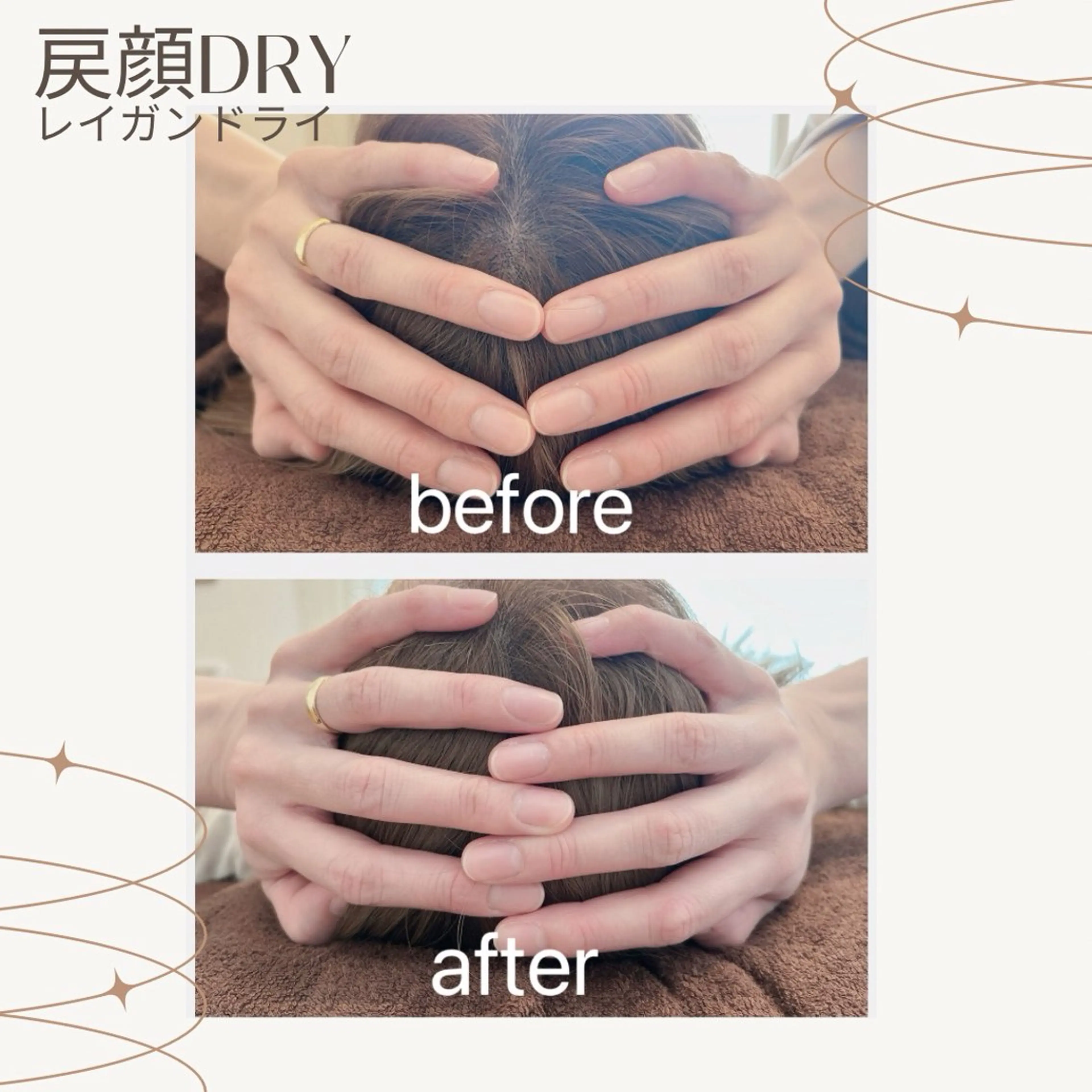 痛くない小顔矯正《レイガンドライ》の写真