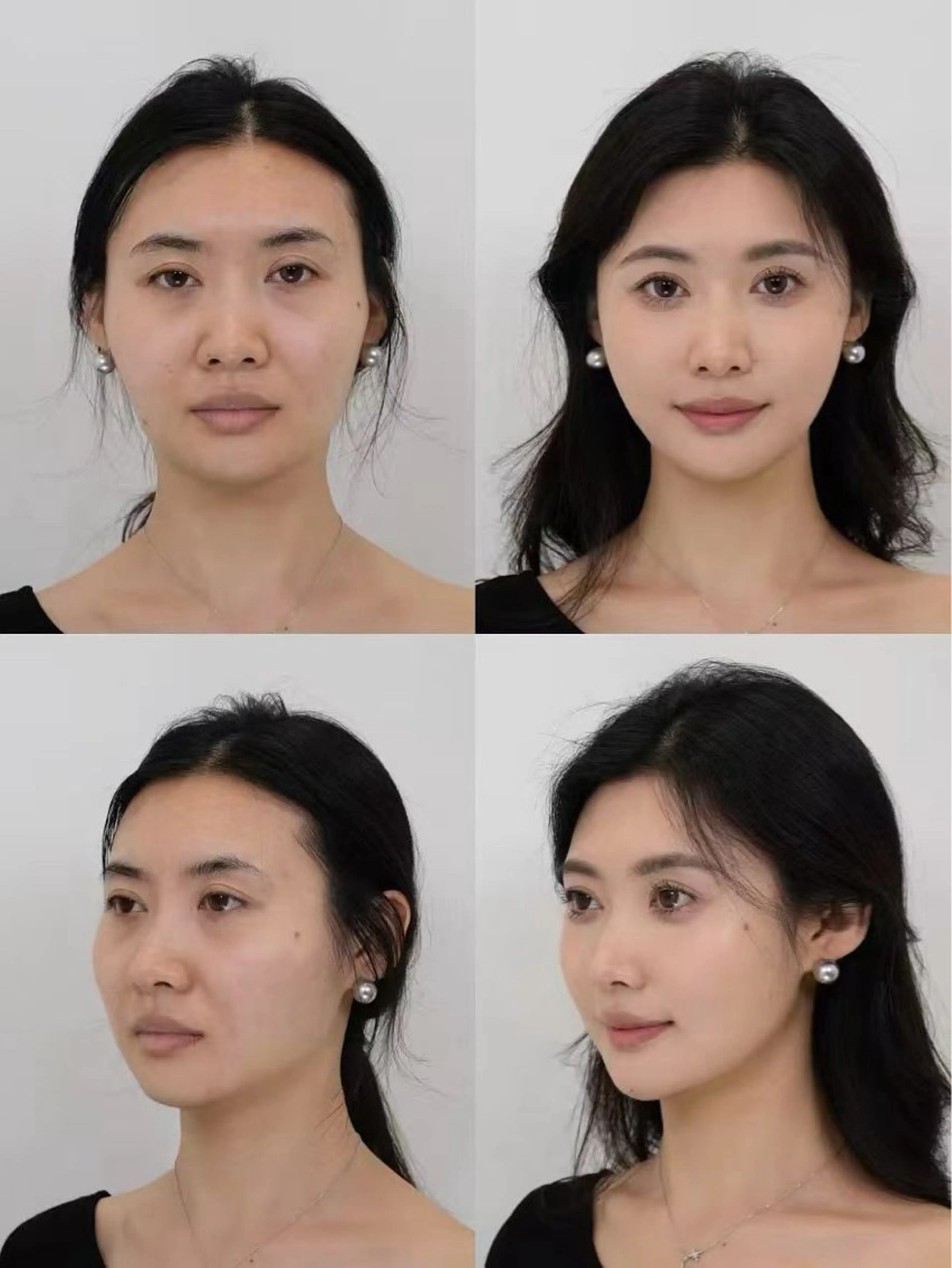 カラー エステ aliaハイフ&水光ジェットサロン所属・aliaハーブ水光店 エステティシャン募集のエステ・リラクイメージ