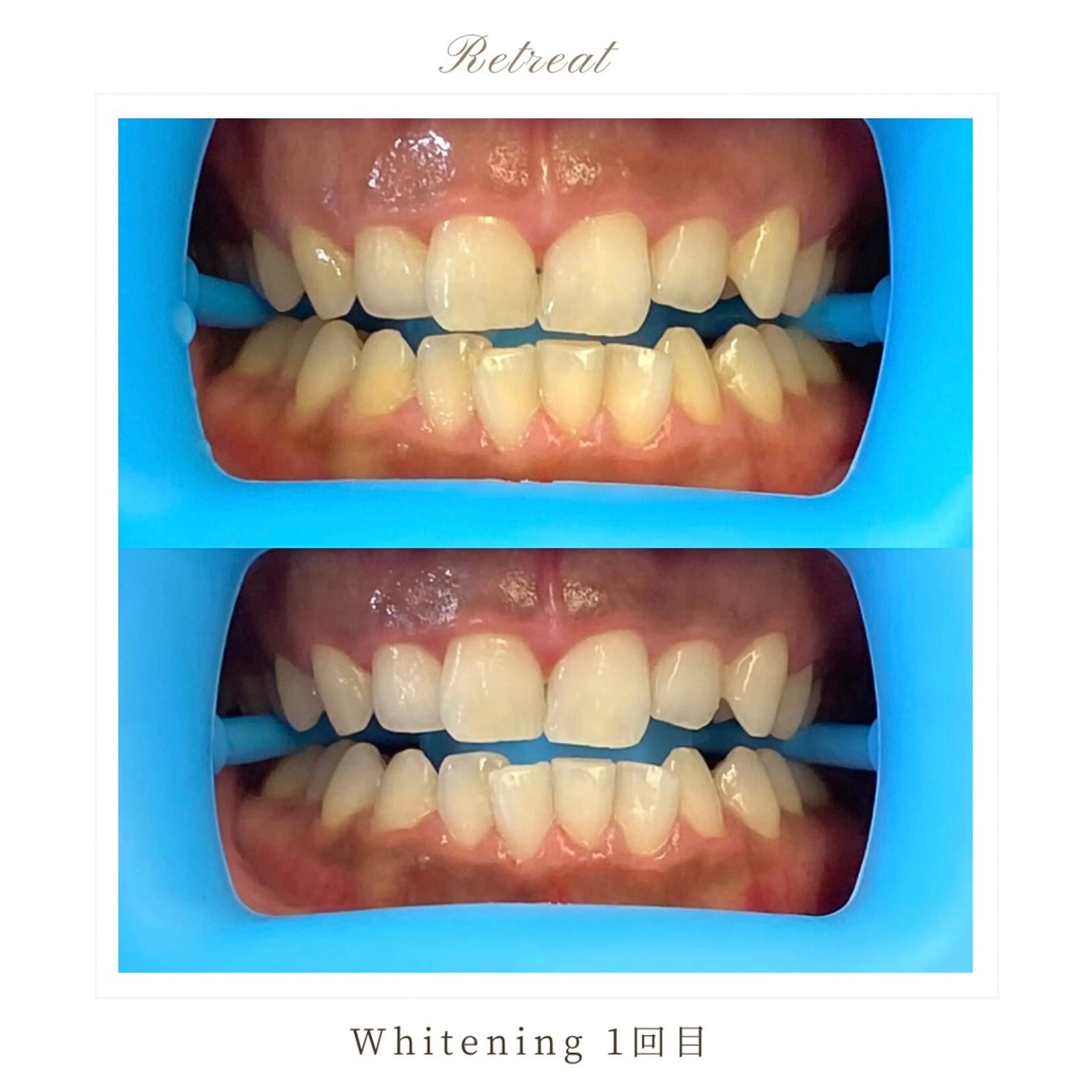 歯科医院提携 Retreatのエステ・リラクイメージ