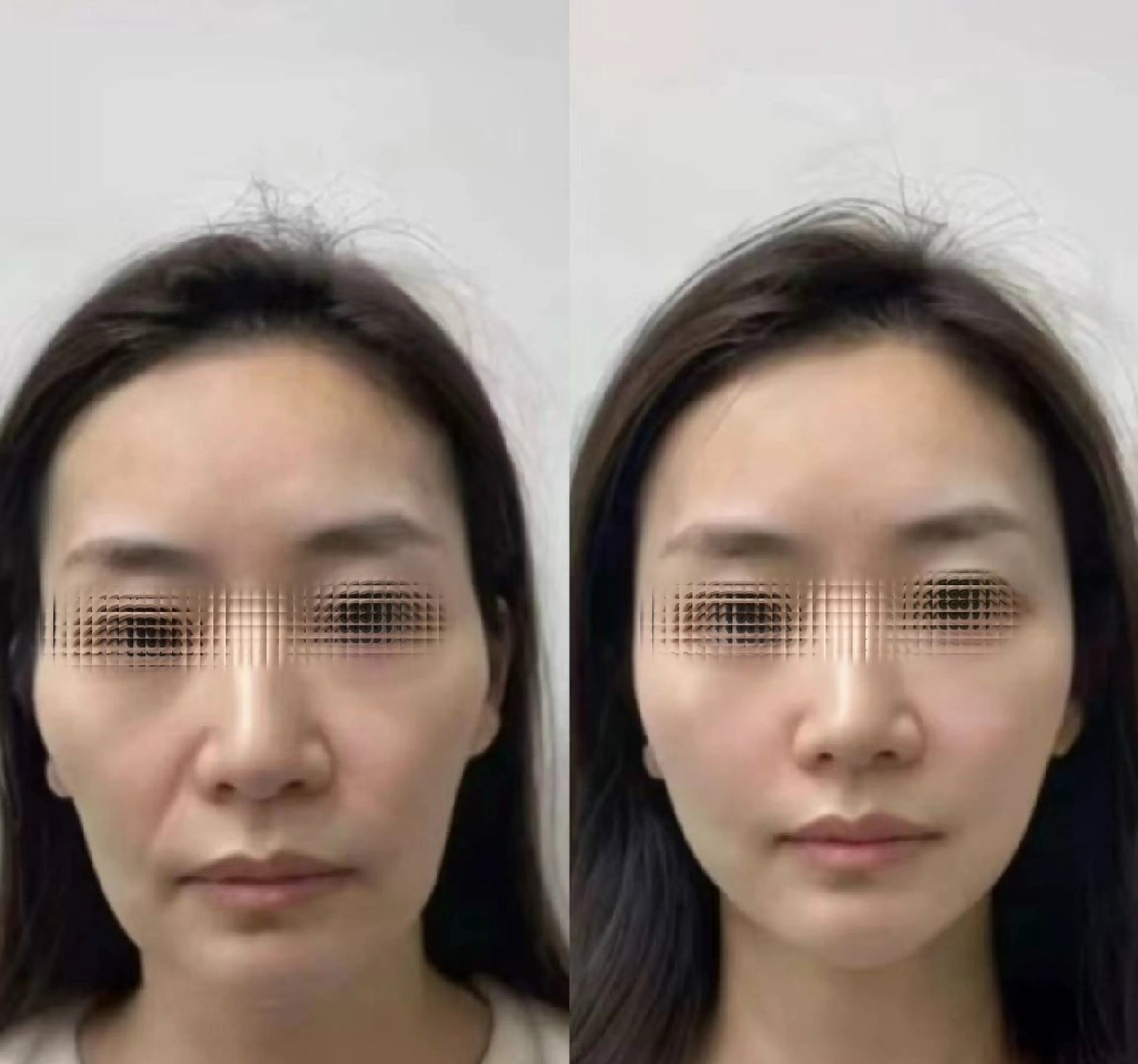 ネイル 韓国ネイル ブライダルネイル ホワイト aliaハイフ&水光ジェットサロン所属・aliaハーブ水光店 エステティシャン募集のエステ・リラクイメージ