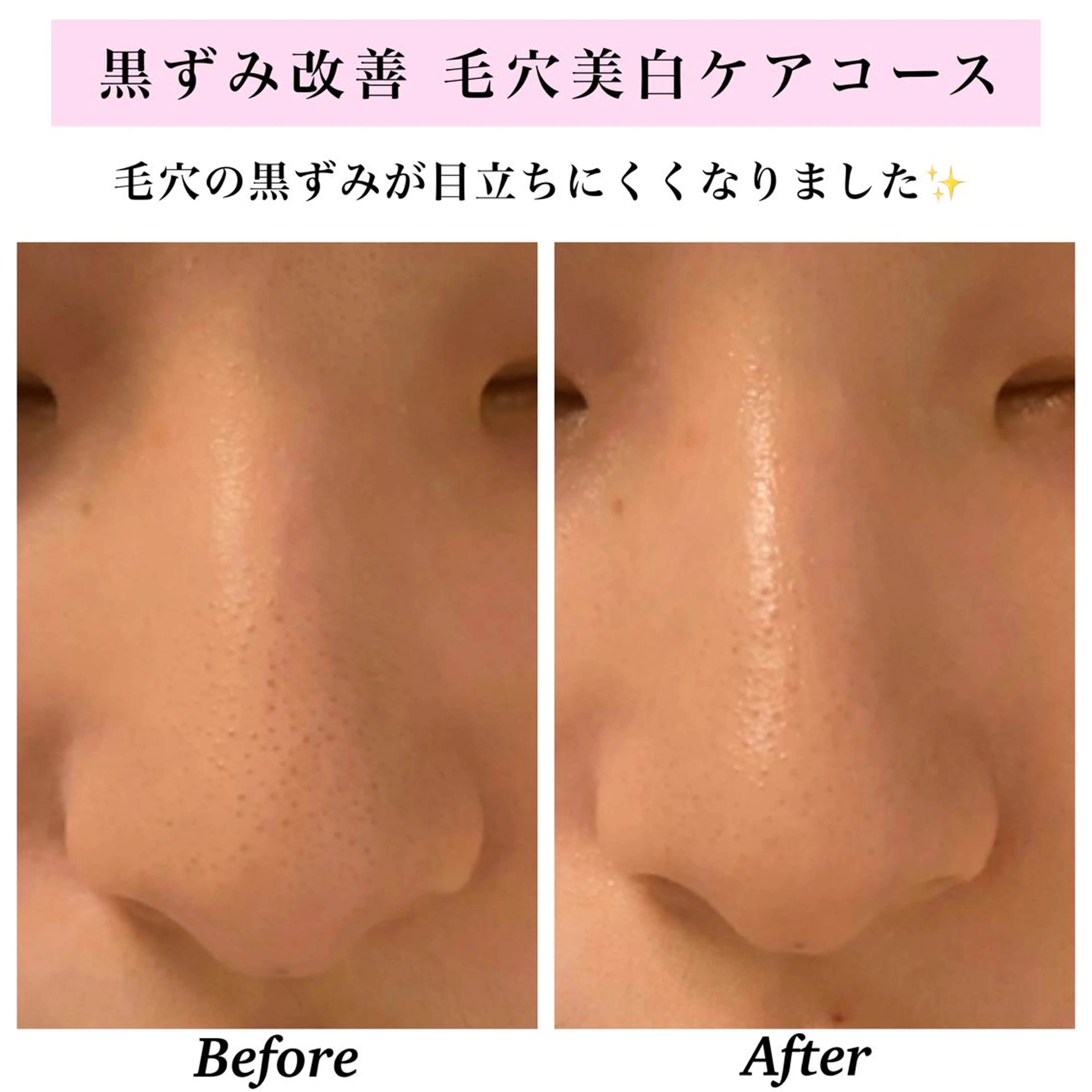 エステ リラク Bellesthe (ベルエステ)のエステ・リラクイメージ