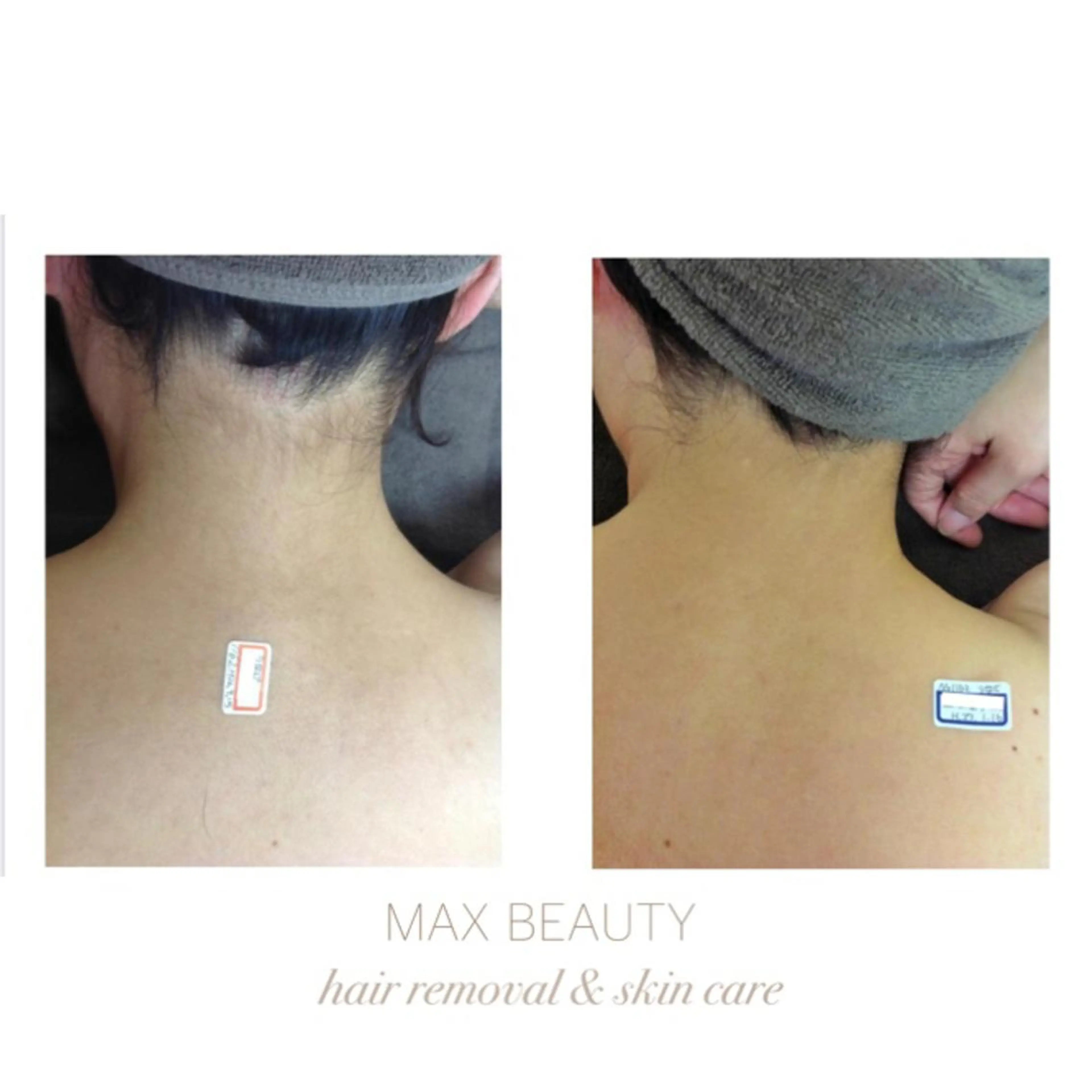 痩身/美肌/脱毛 MAX BEAUTYのエステ・リラクイメージ