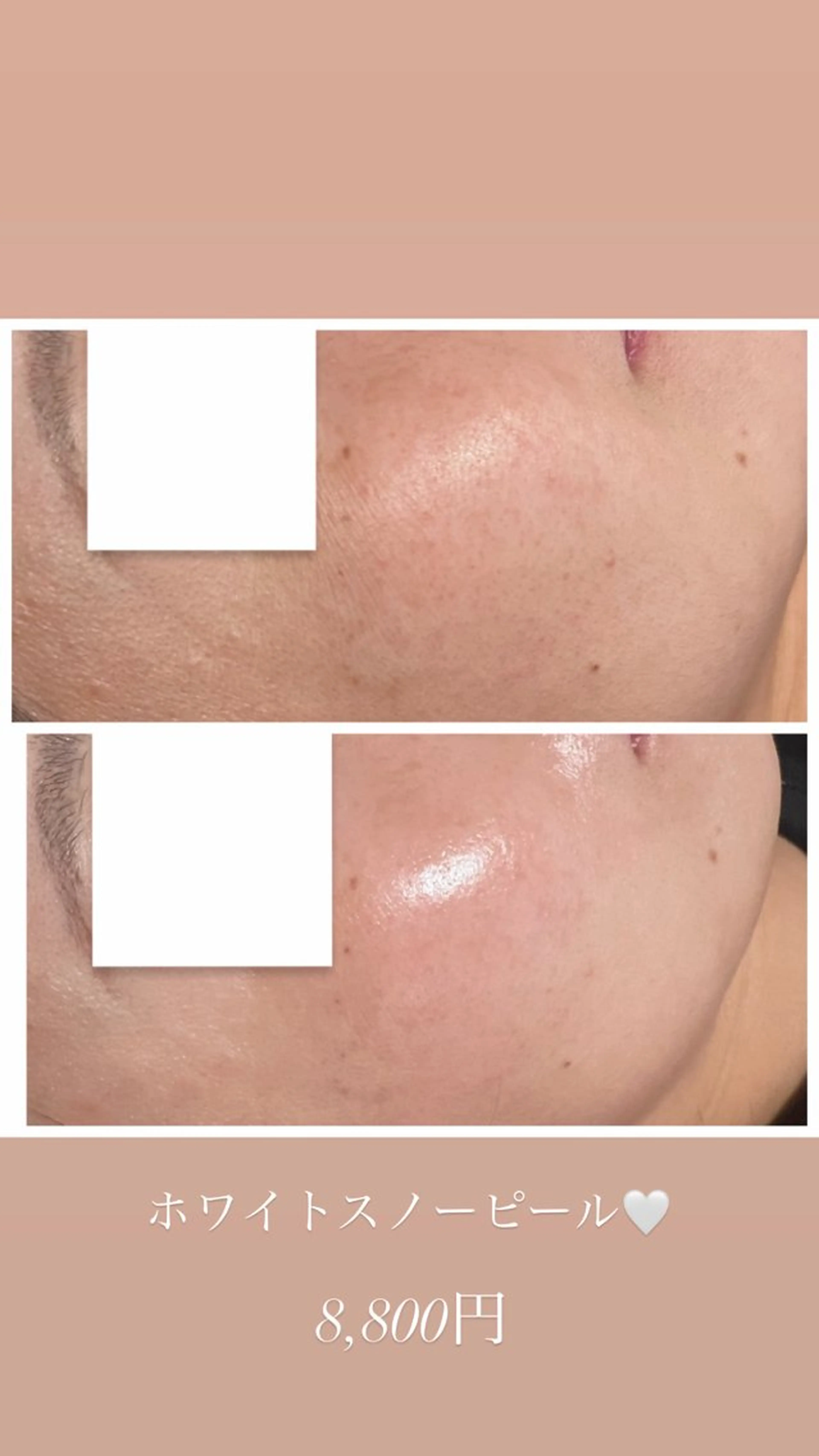 Raviy 【痩身・韓国肌管理】のエステ・リラクイメージ