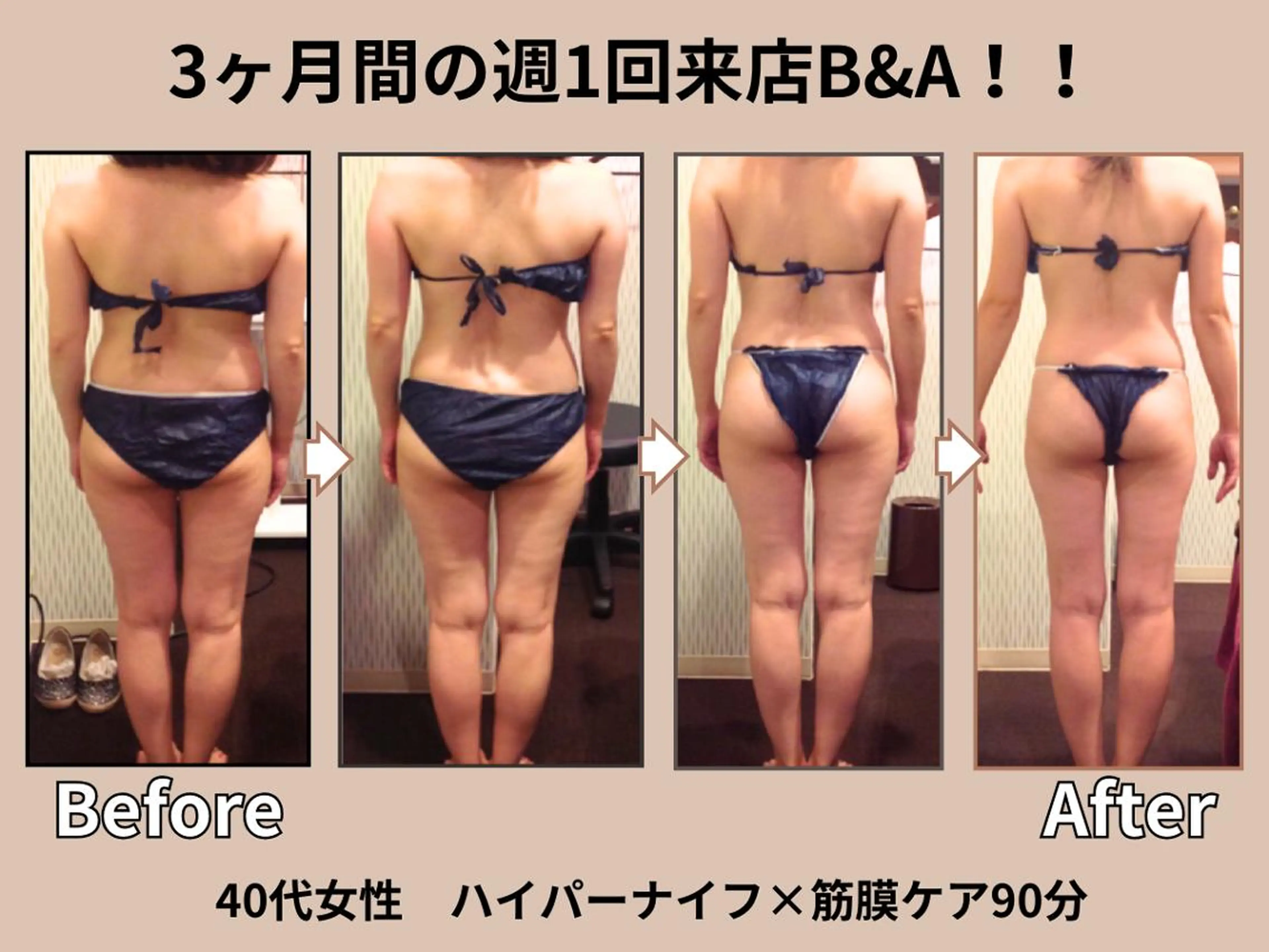 その他 痩身&小顔矯正専門店 Re:Livesのエステ・リラクイメージ