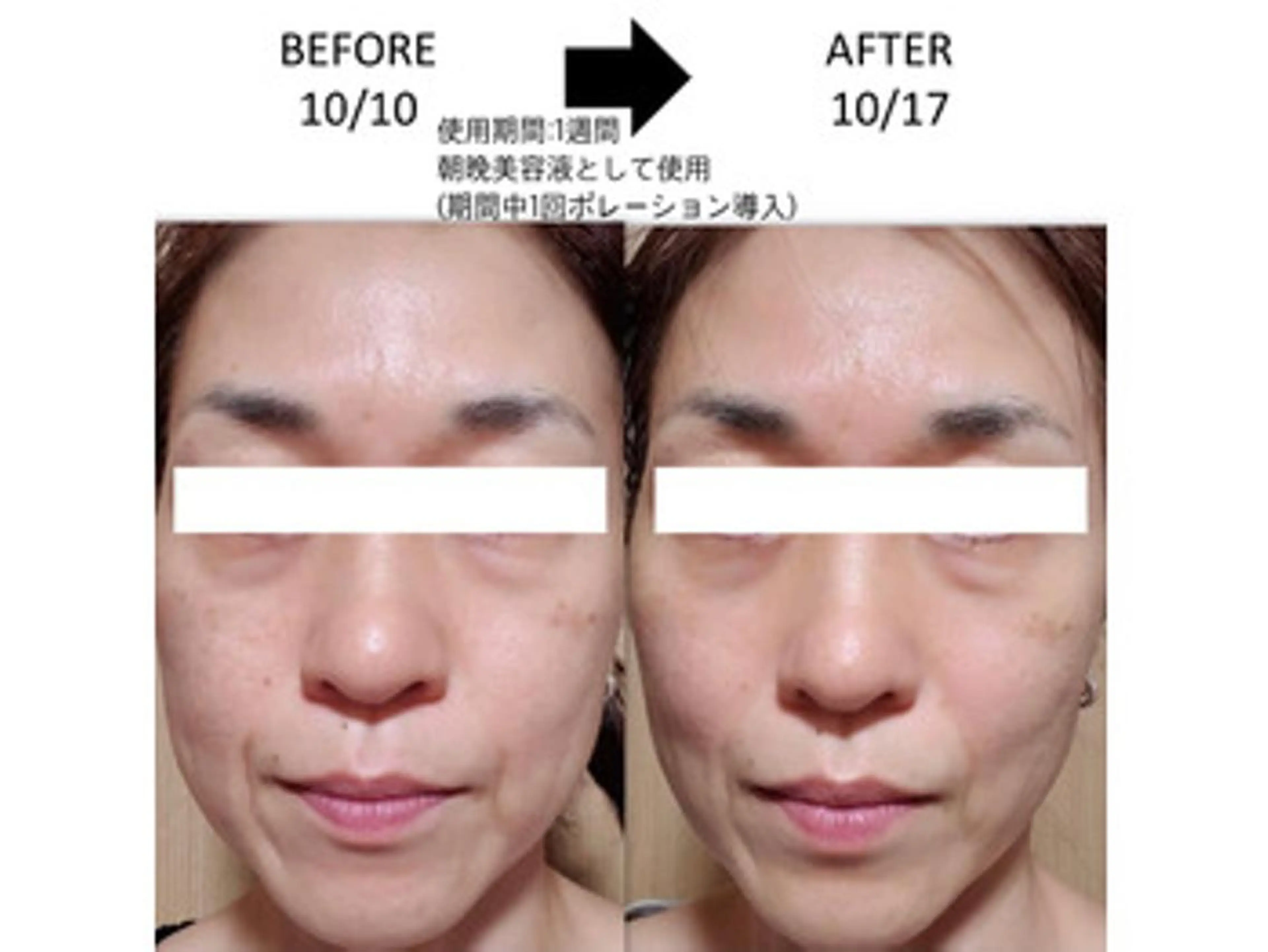 PLACE梅田堂山店 【肌質改善/ハーブ】のエステ・リラクイメージ