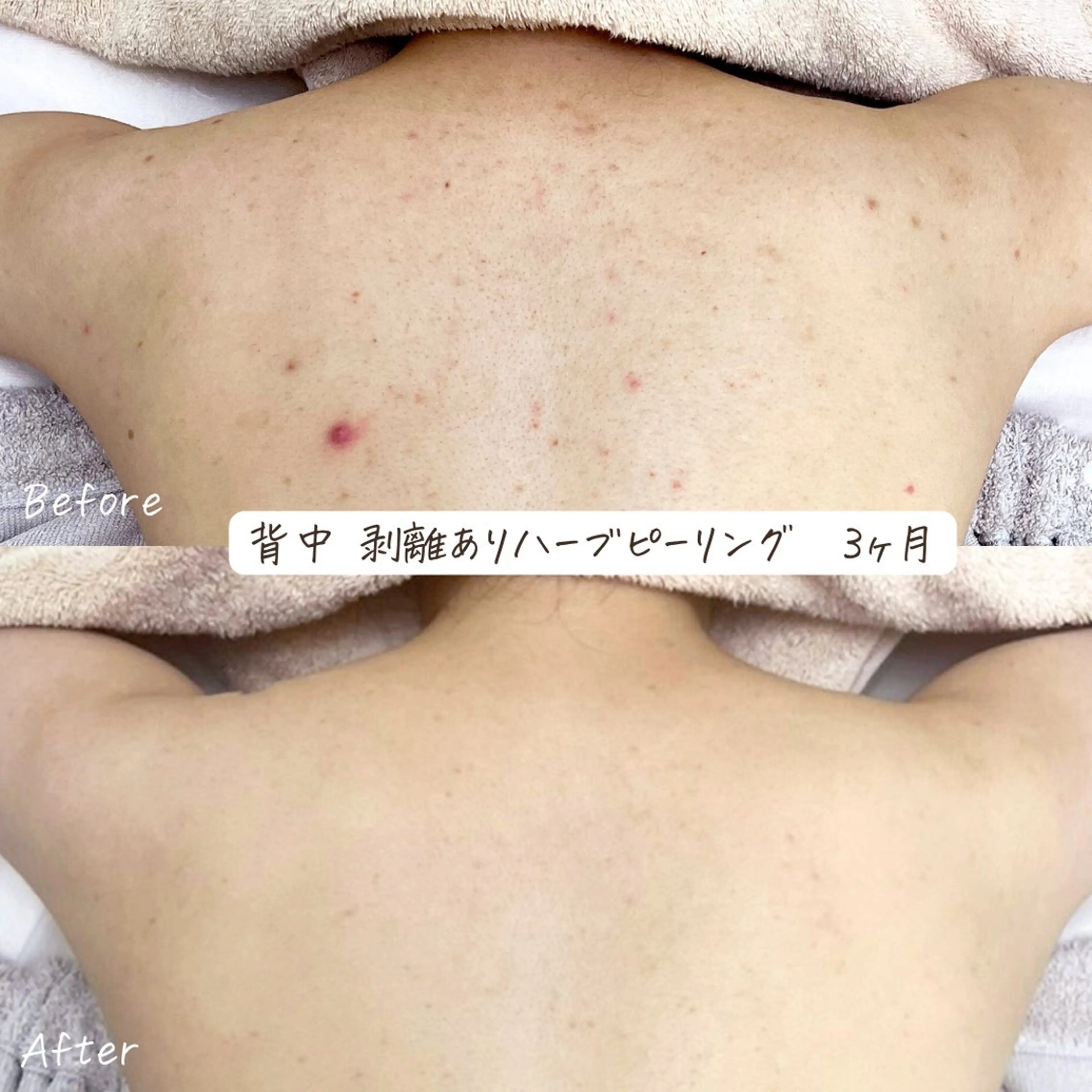 肌質改善サロン renew/ｳｴｷのエステ・リラクイメージ