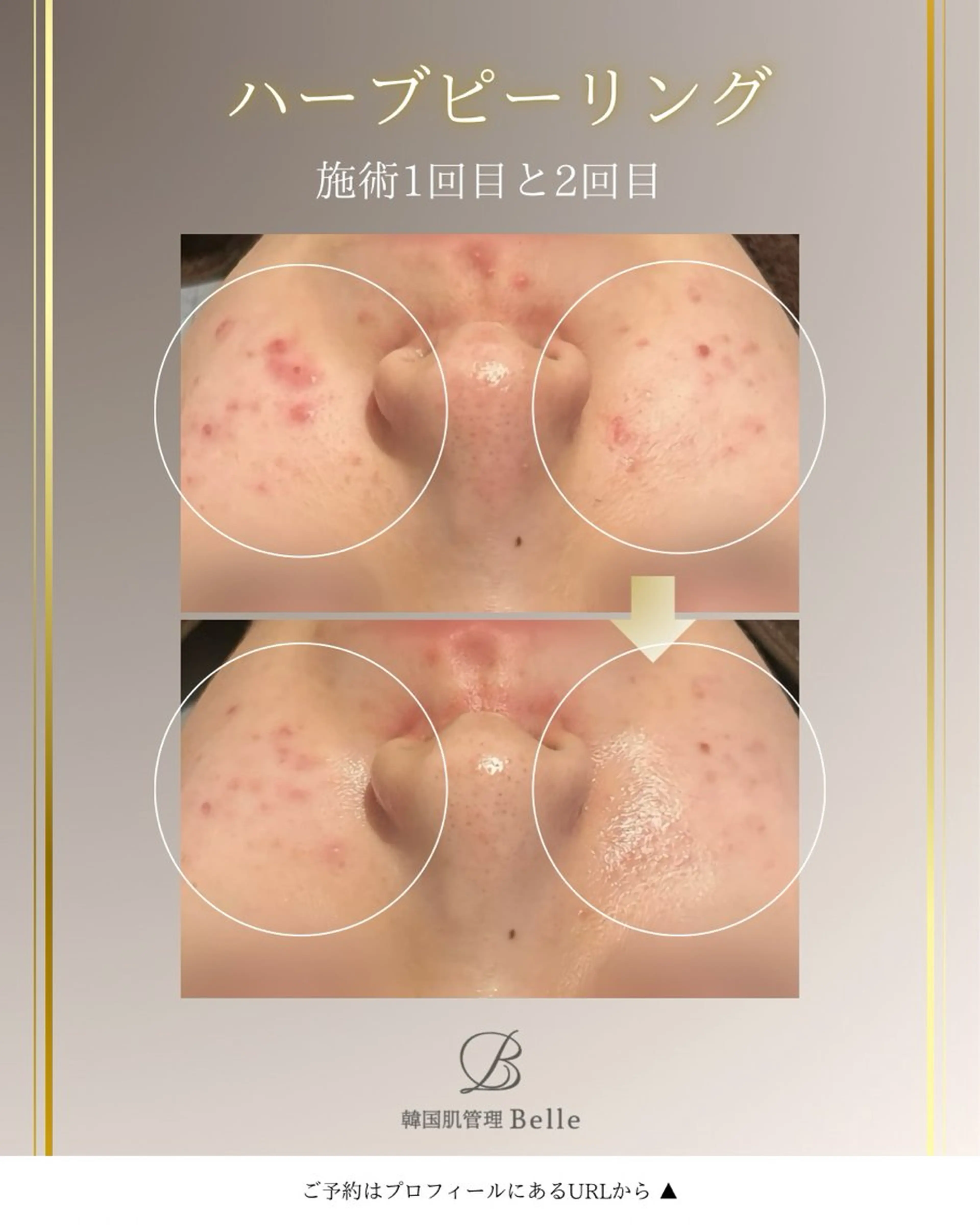 韓国肌管理Belle 西宮北口店のエステ・リラクイメージ