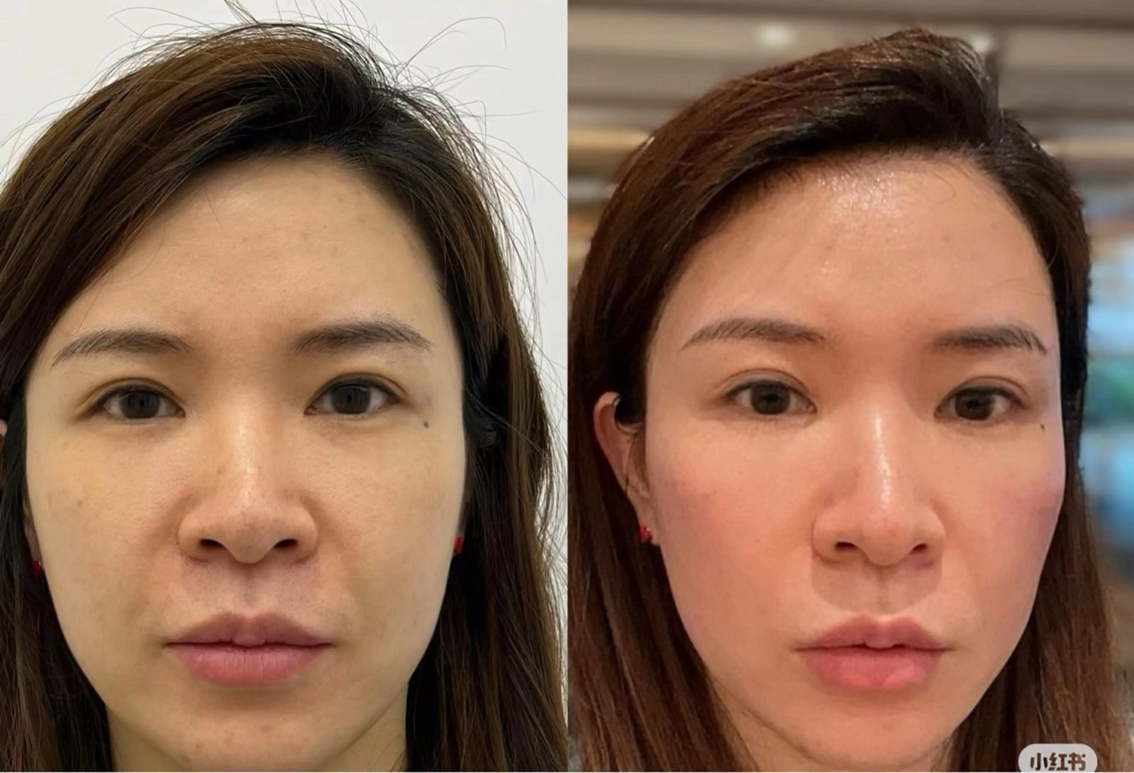 マツエク・マツパ aliaハーブ水光店 エステティシャン募集のエステ・リラクイメージ