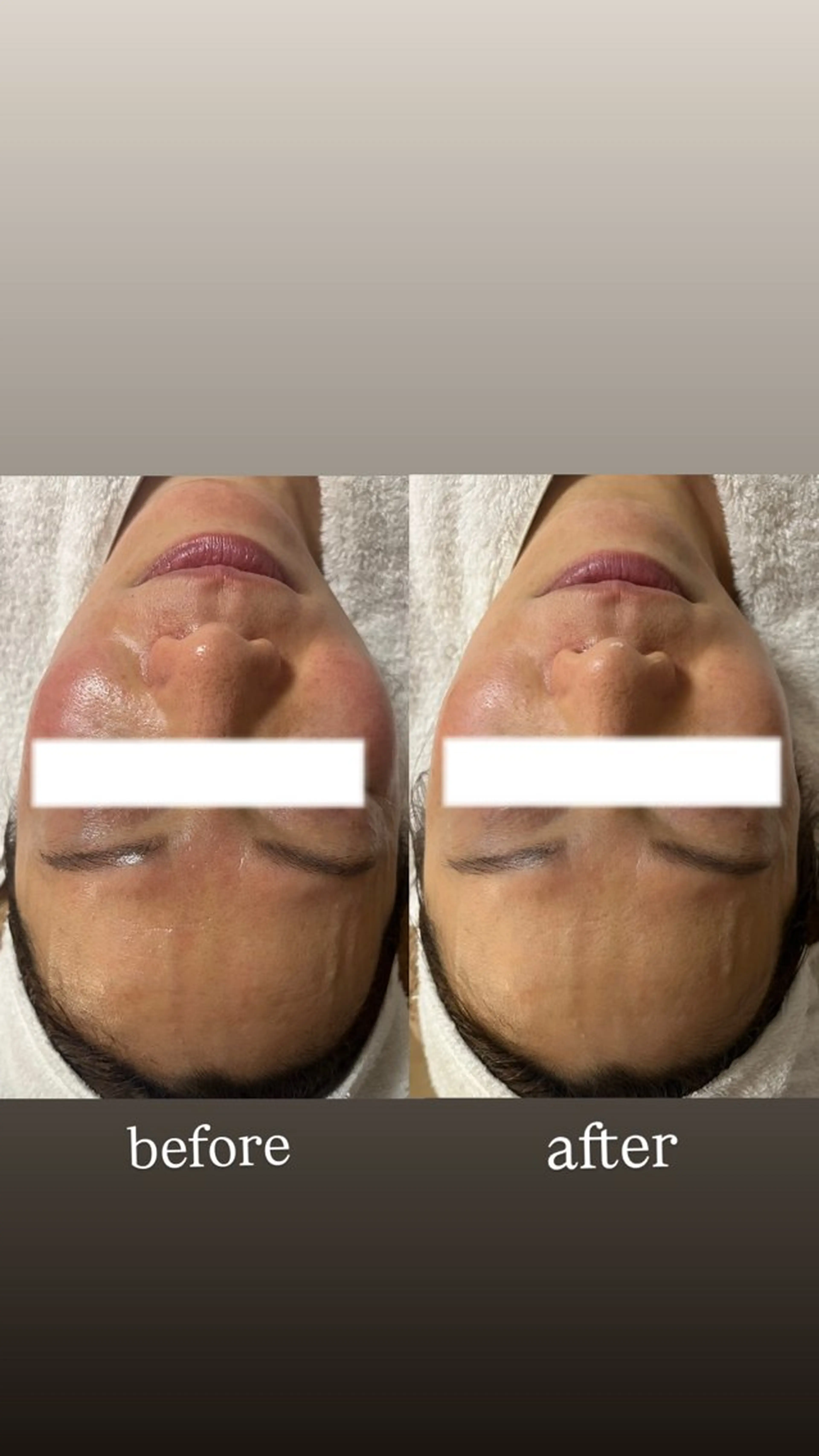 エステ リラク 肌質改善専門店 メナード上里のエステ・リラクイメージ