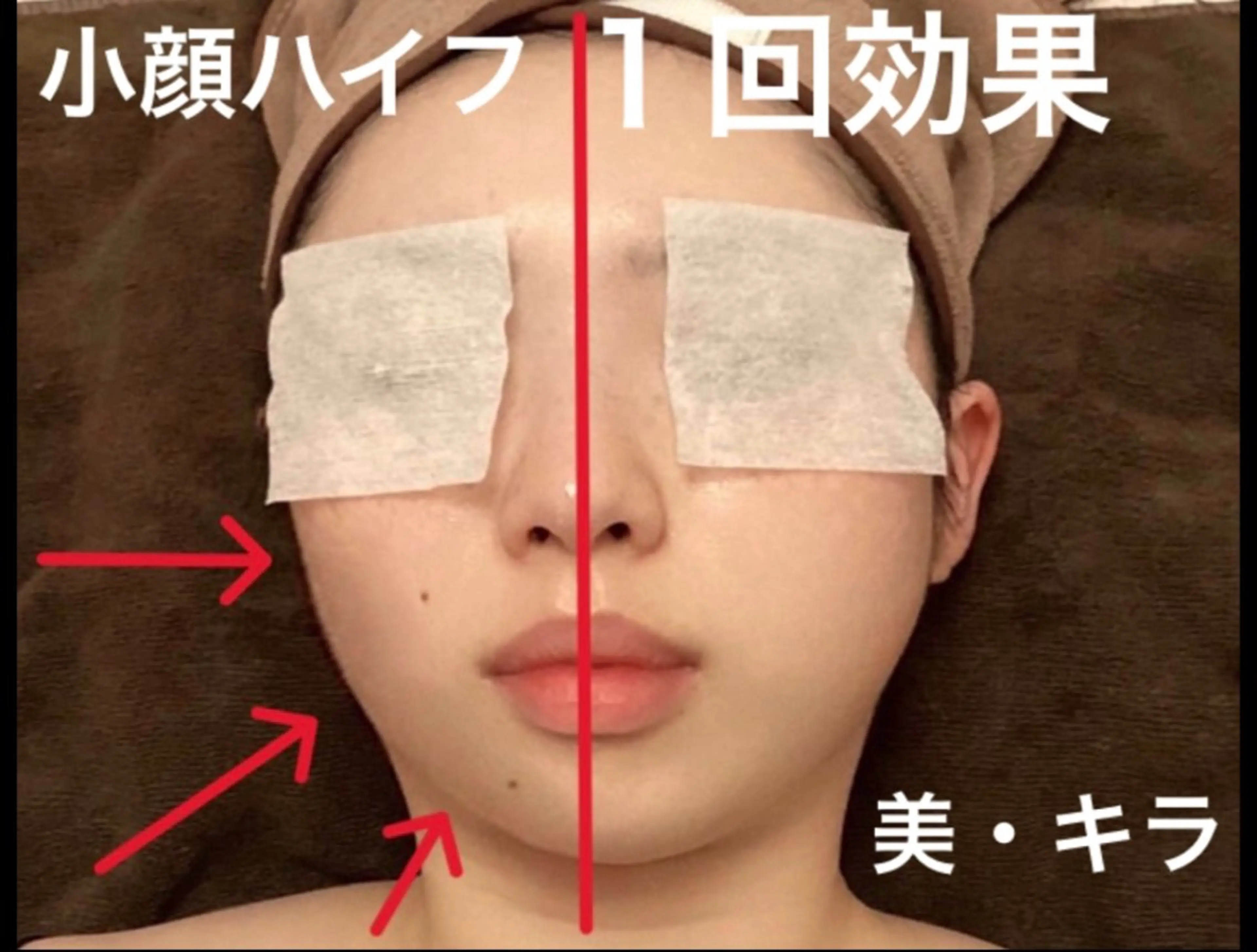 エステ リラク 美・キラ ハイフ痩身&美肌のエステ・リラクイメージ