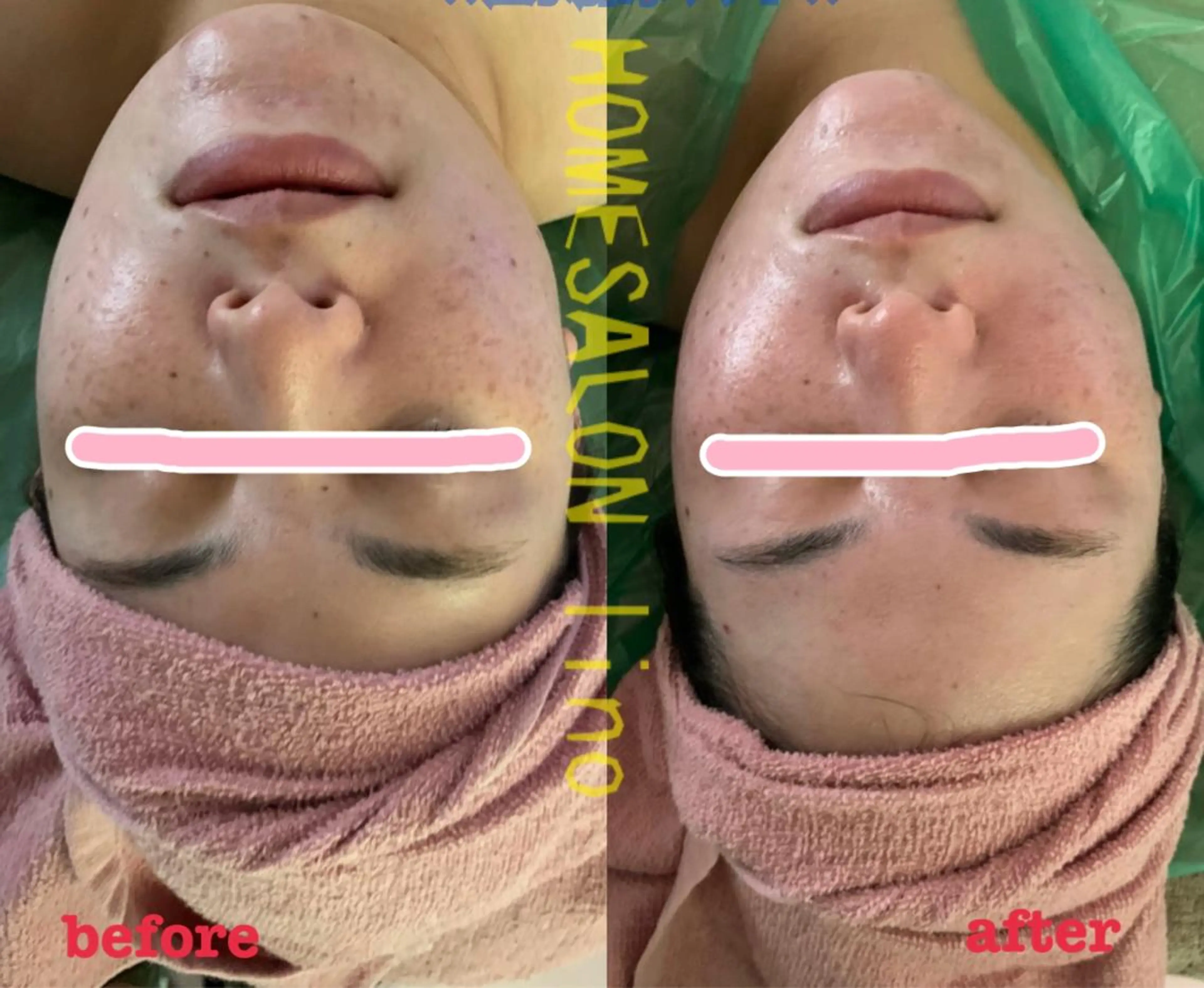 エステ リラク HOME SALON linoのエステ・リラクイメージ