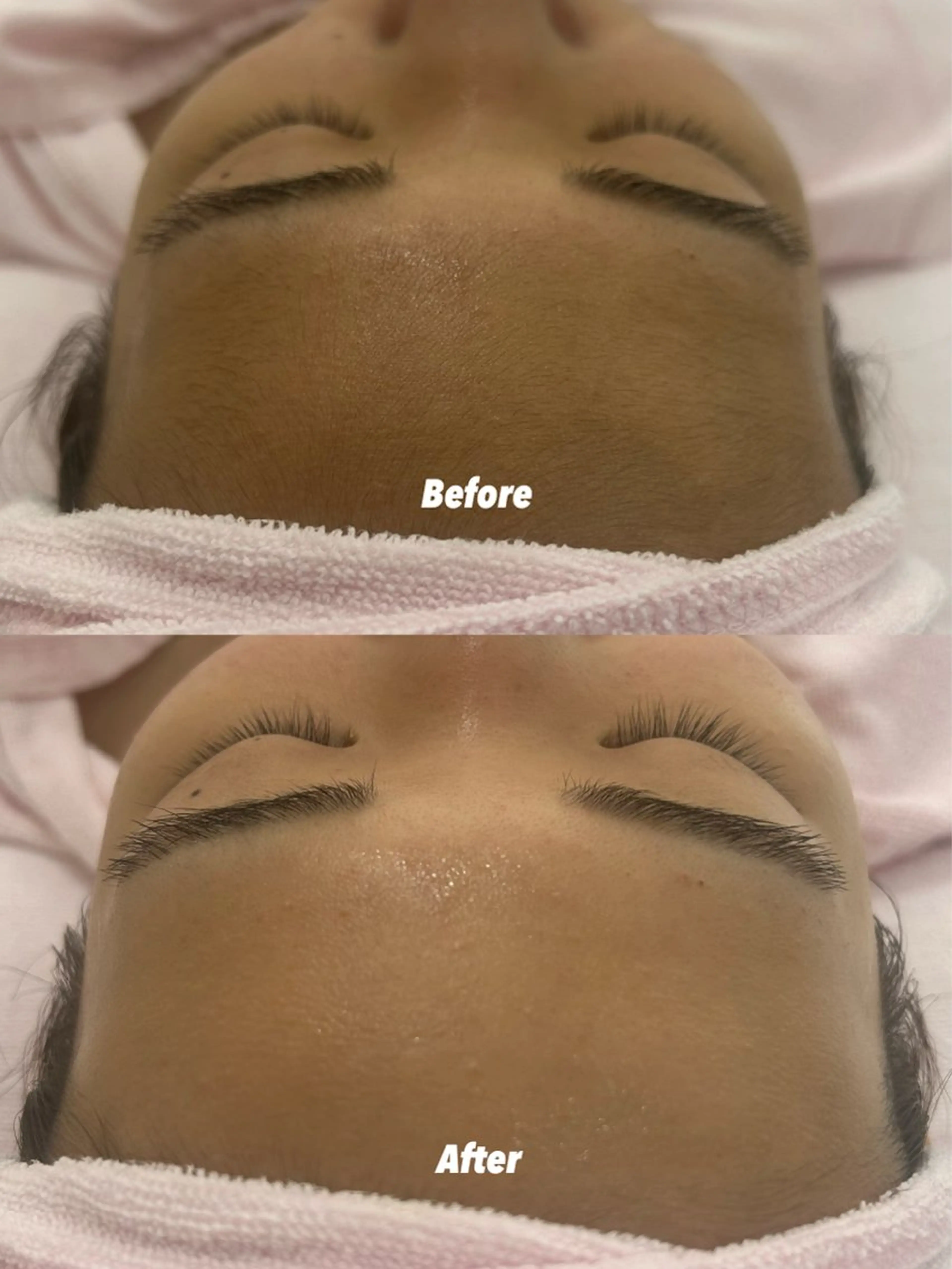 エステ リラク 🫧美しい素肌へ🫧 今成柚乃のその他イメージ