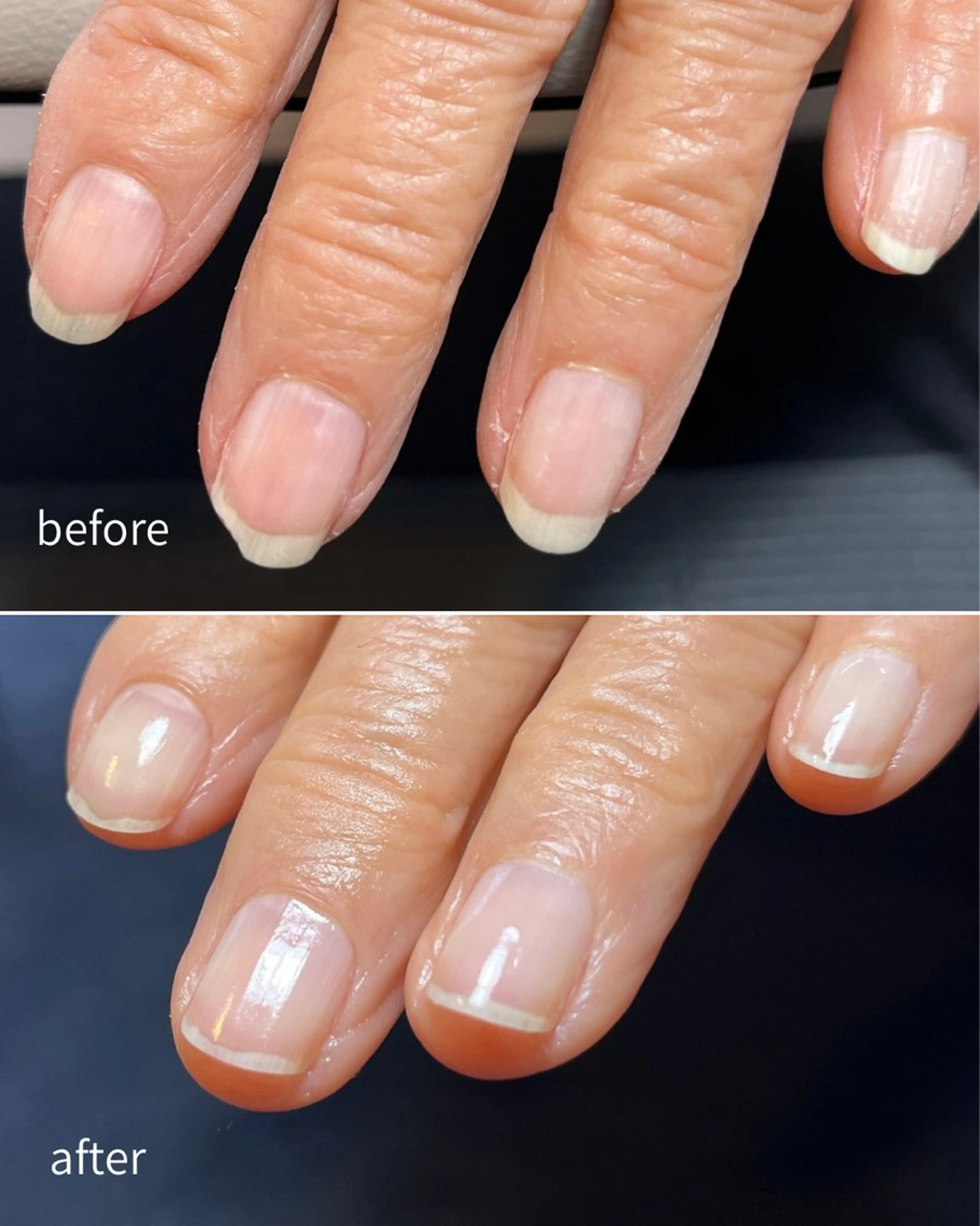 ネイル VERMA 育爪・ケア専門のネイルデザイン