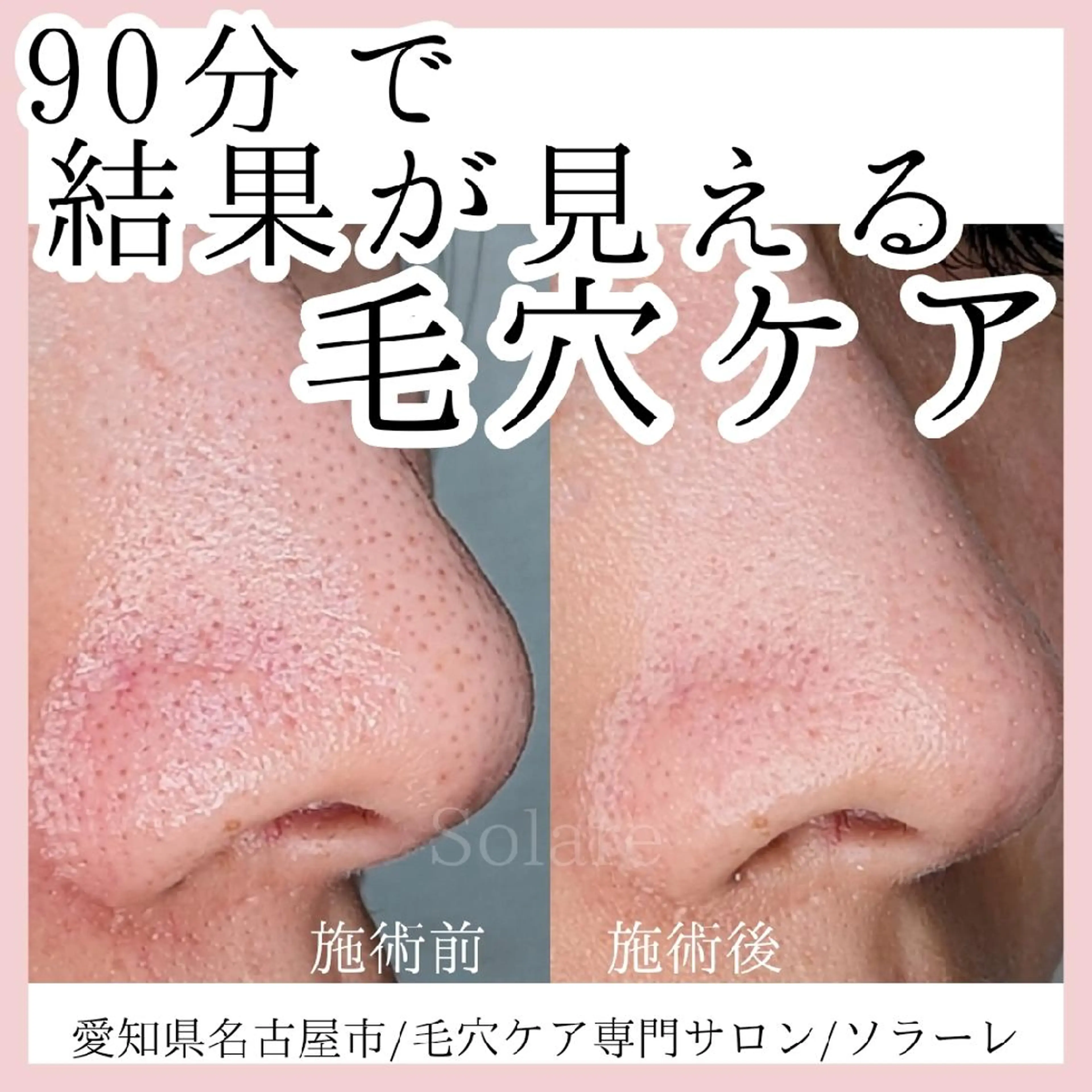  毛穴洗浄・まつ毛 の専門店 ソラーレのエステ・リラクイメージ