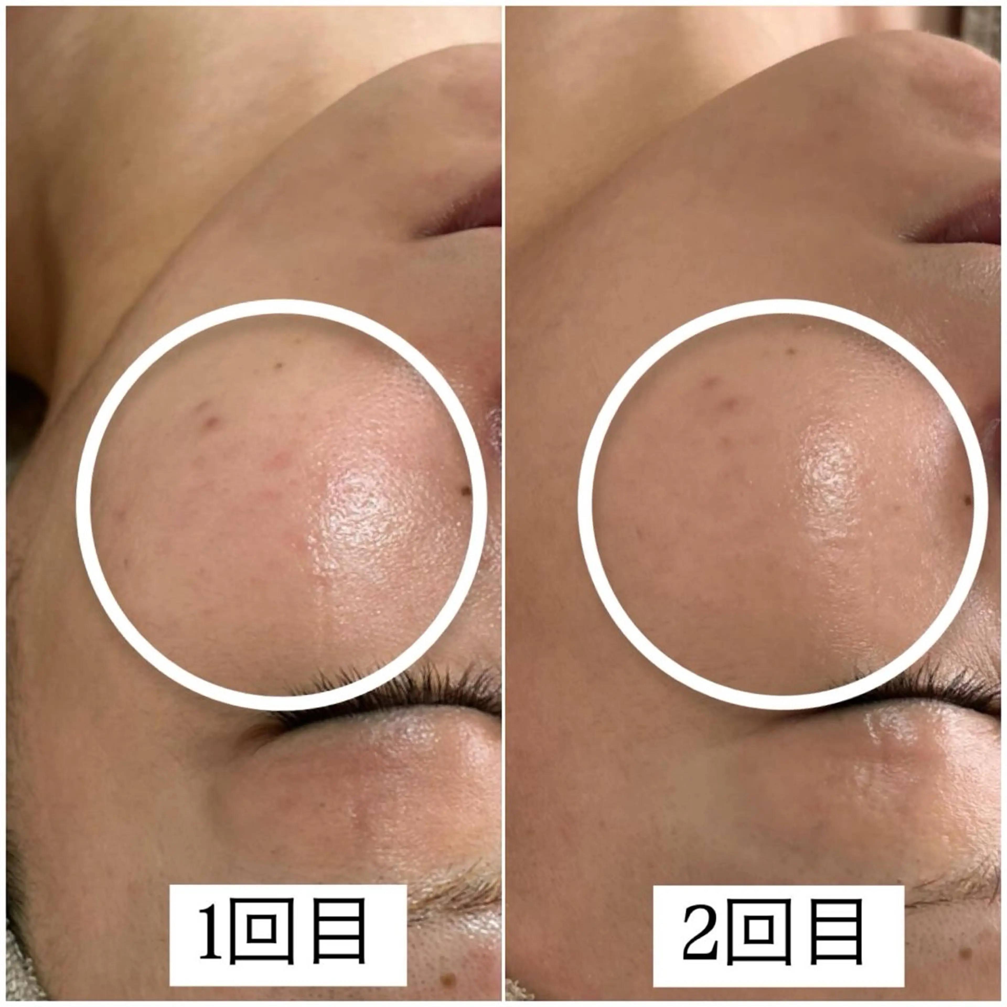 エステ 1st｜フェイシャル エステ専門店のエステ・リラクイメージ