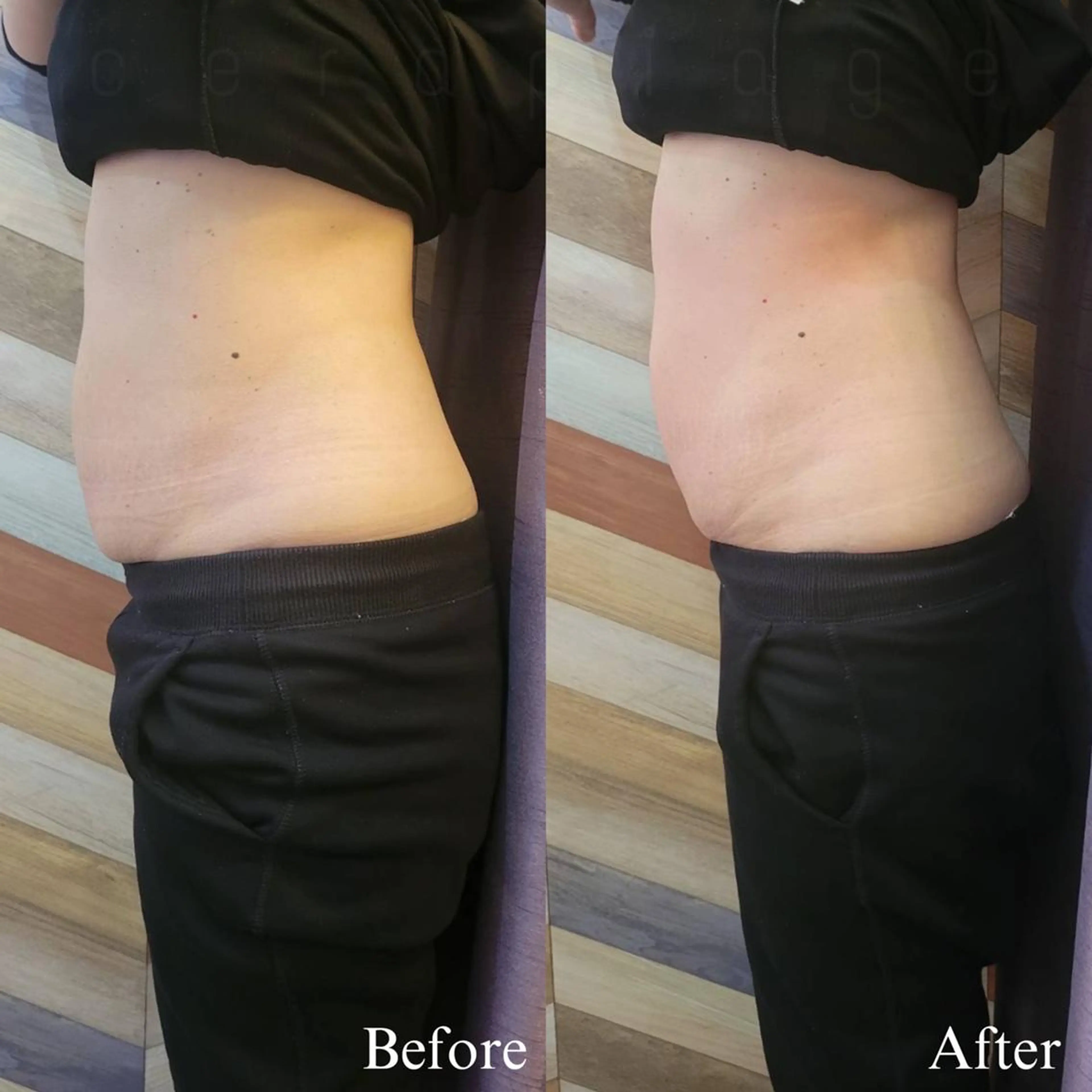 小顔/毛穴/肌質改善 💆セラピエージのエステ・リラクイメージ