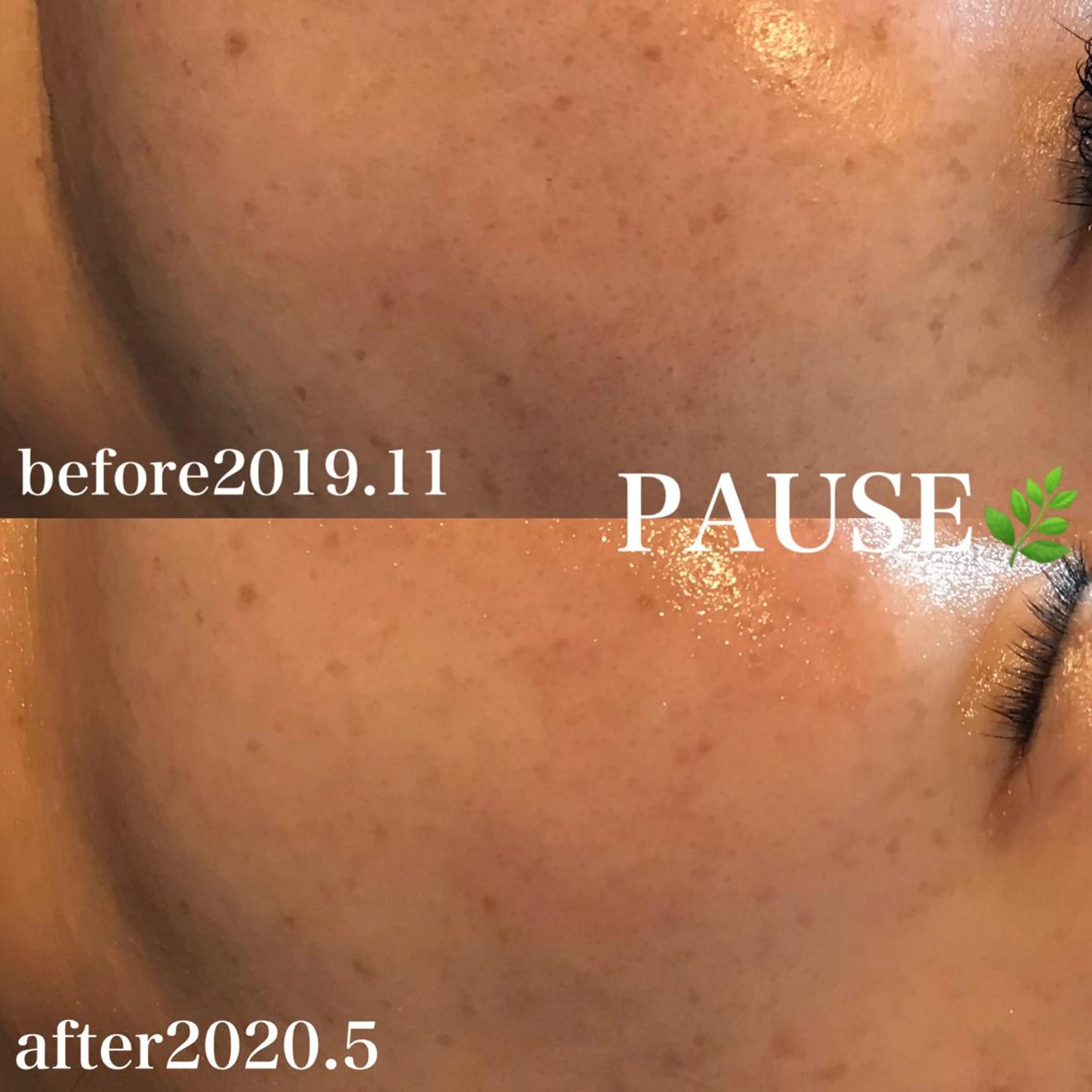 エステ 浜野 恵美のエステ・リラクイメージ