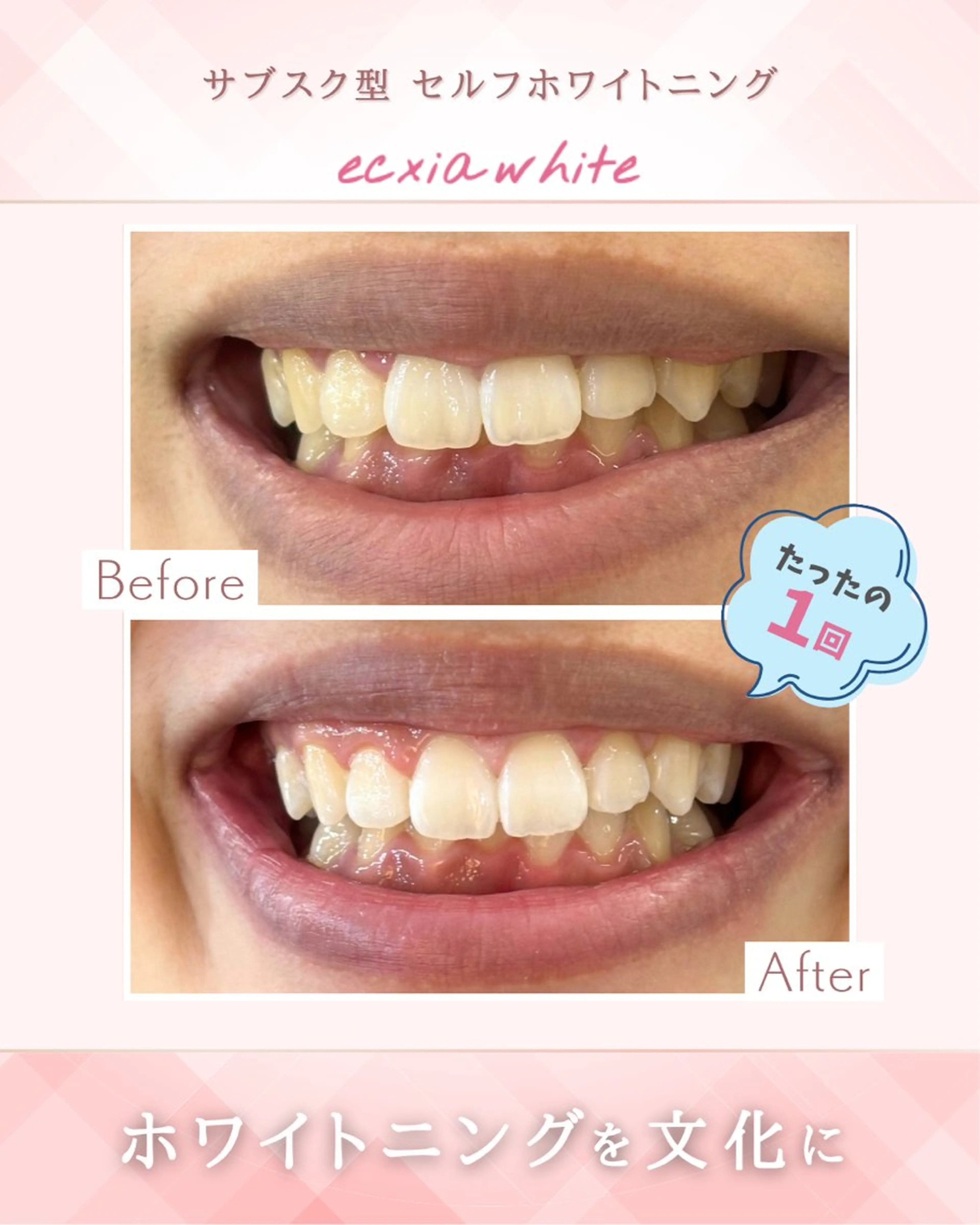 セルフホワイトニング エクシア大阪天王寺店のその他イメージ