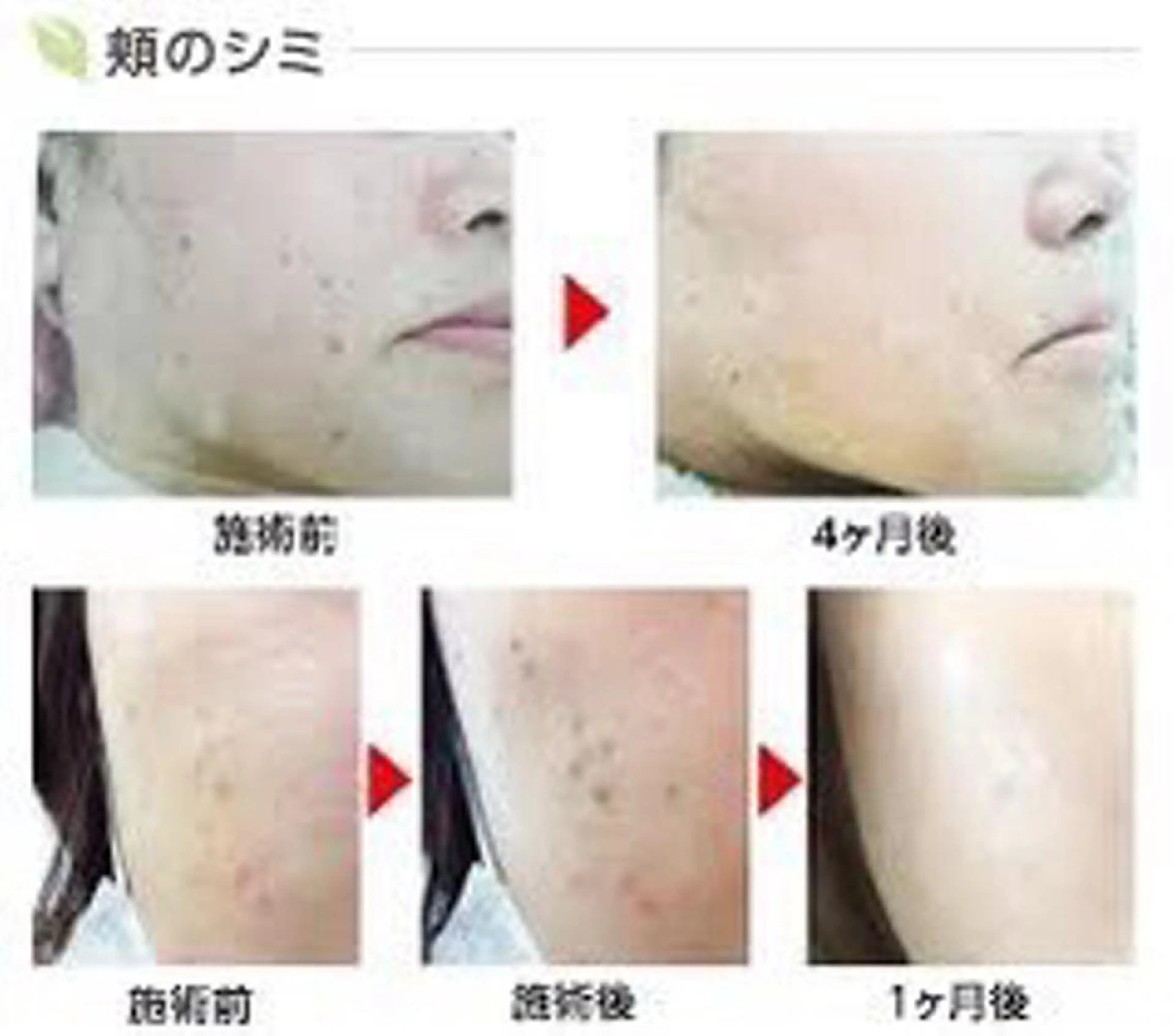 Ｍ渋谷 ホワイトニングのエステ・リラクイメージ