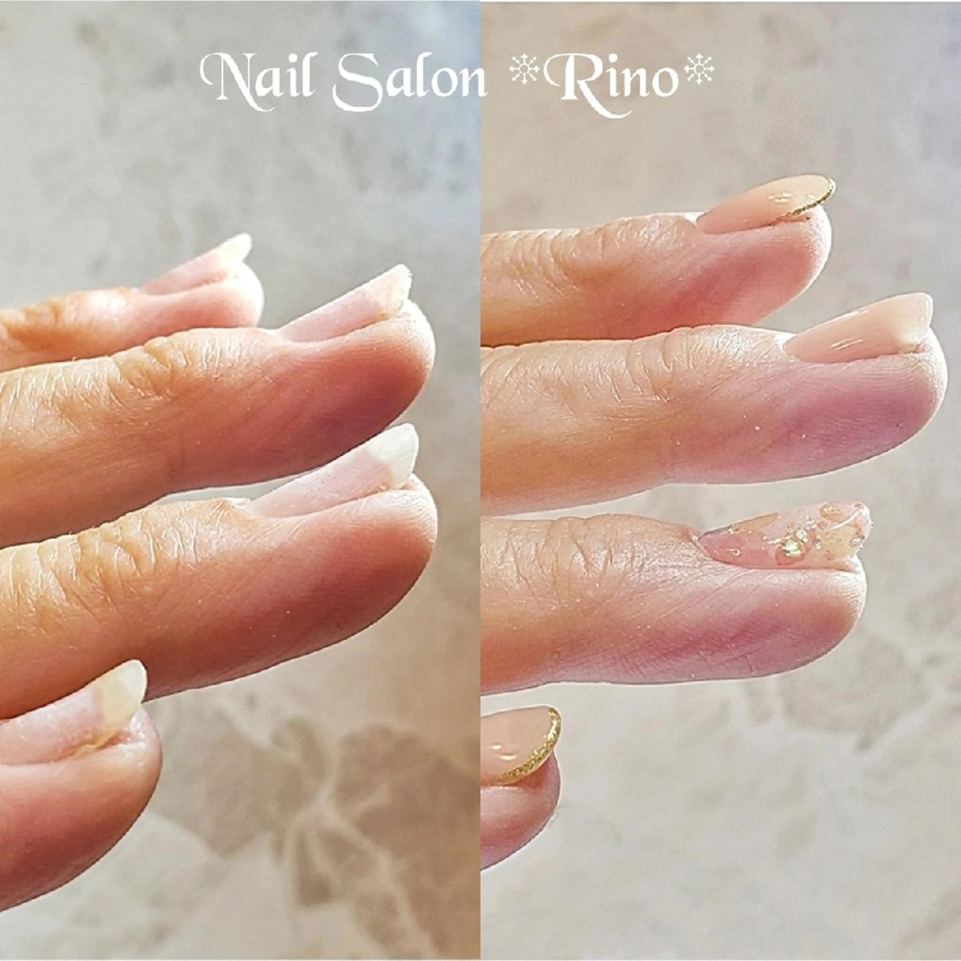 ミディアム ネイル その他(ネイル) Katayama Yokoのネイルデザイン