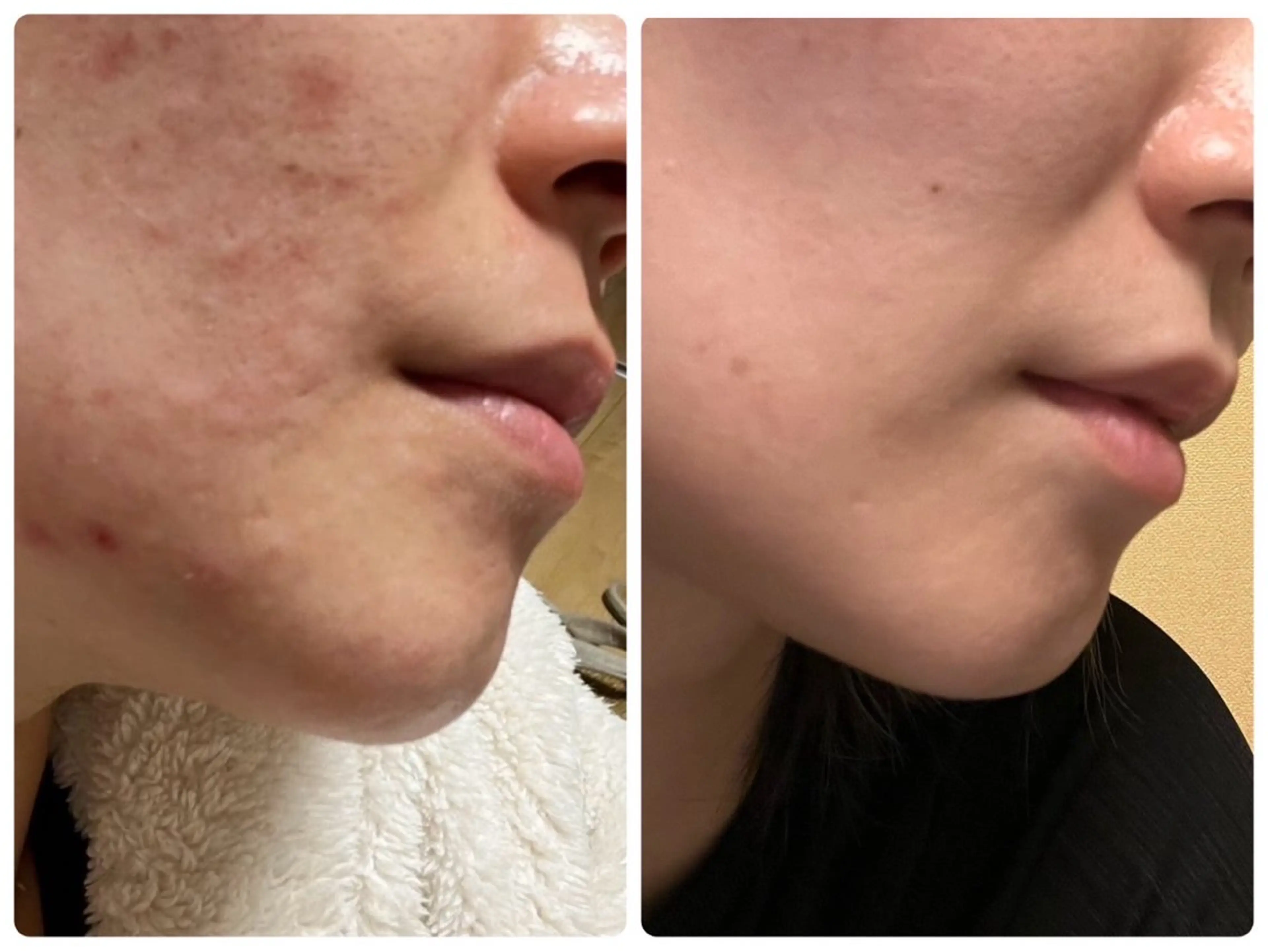 【新規限定】素肌美人コース ¥7,800→6,800（120分）の写真