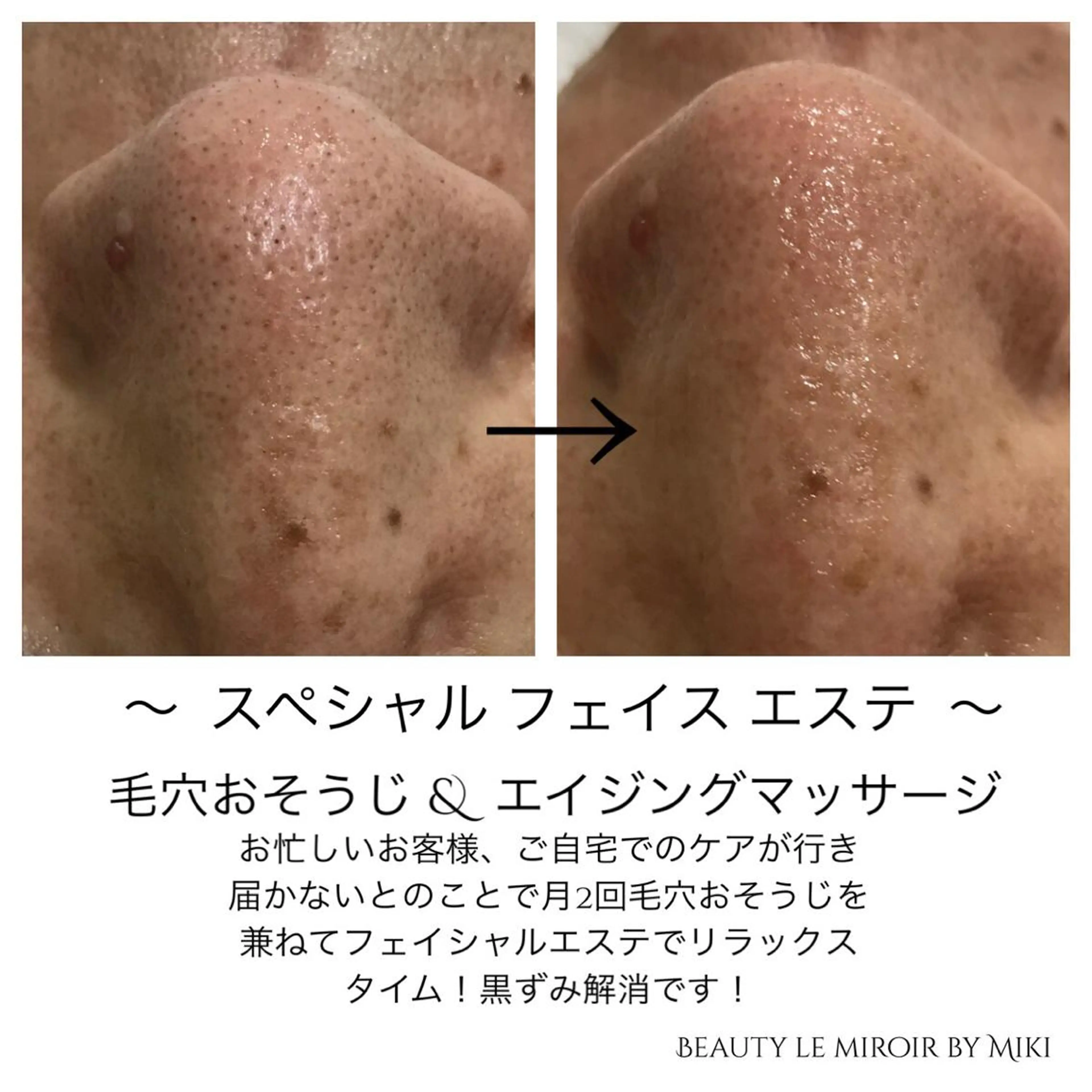 ビューティー ミロワールのエステ・リラクイメージ