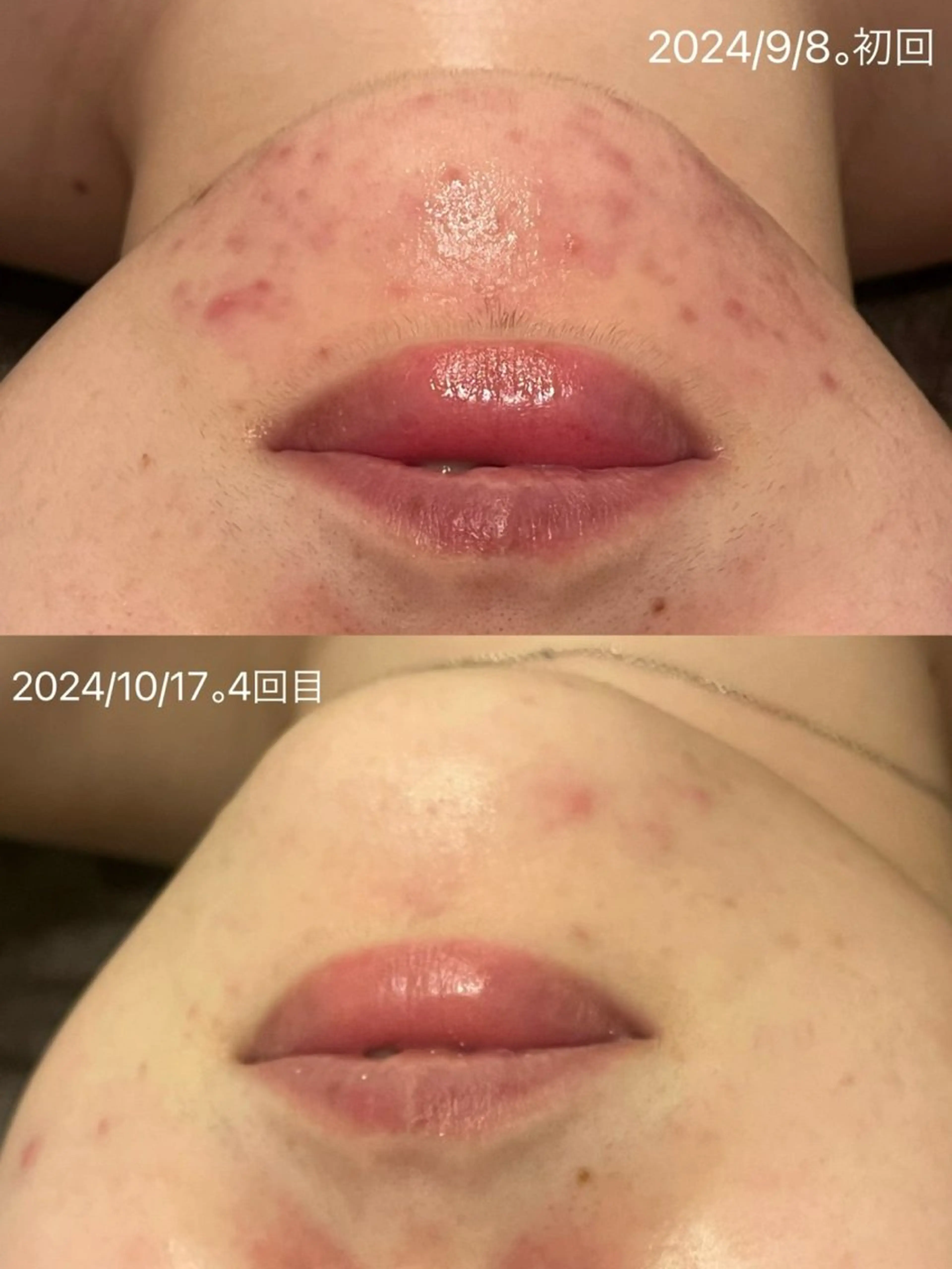 エステ 小顔&まつ毛サロン AKANE❤️のエステ・リラクイメージ