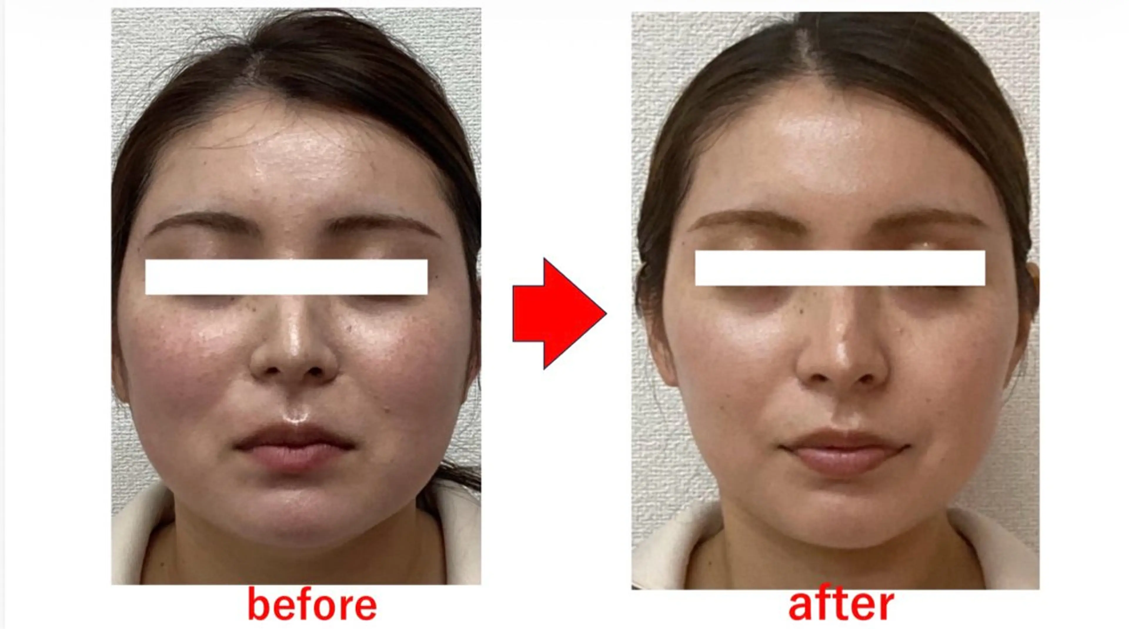 ブプラ 倉敷店のエステ・リラクイメージ