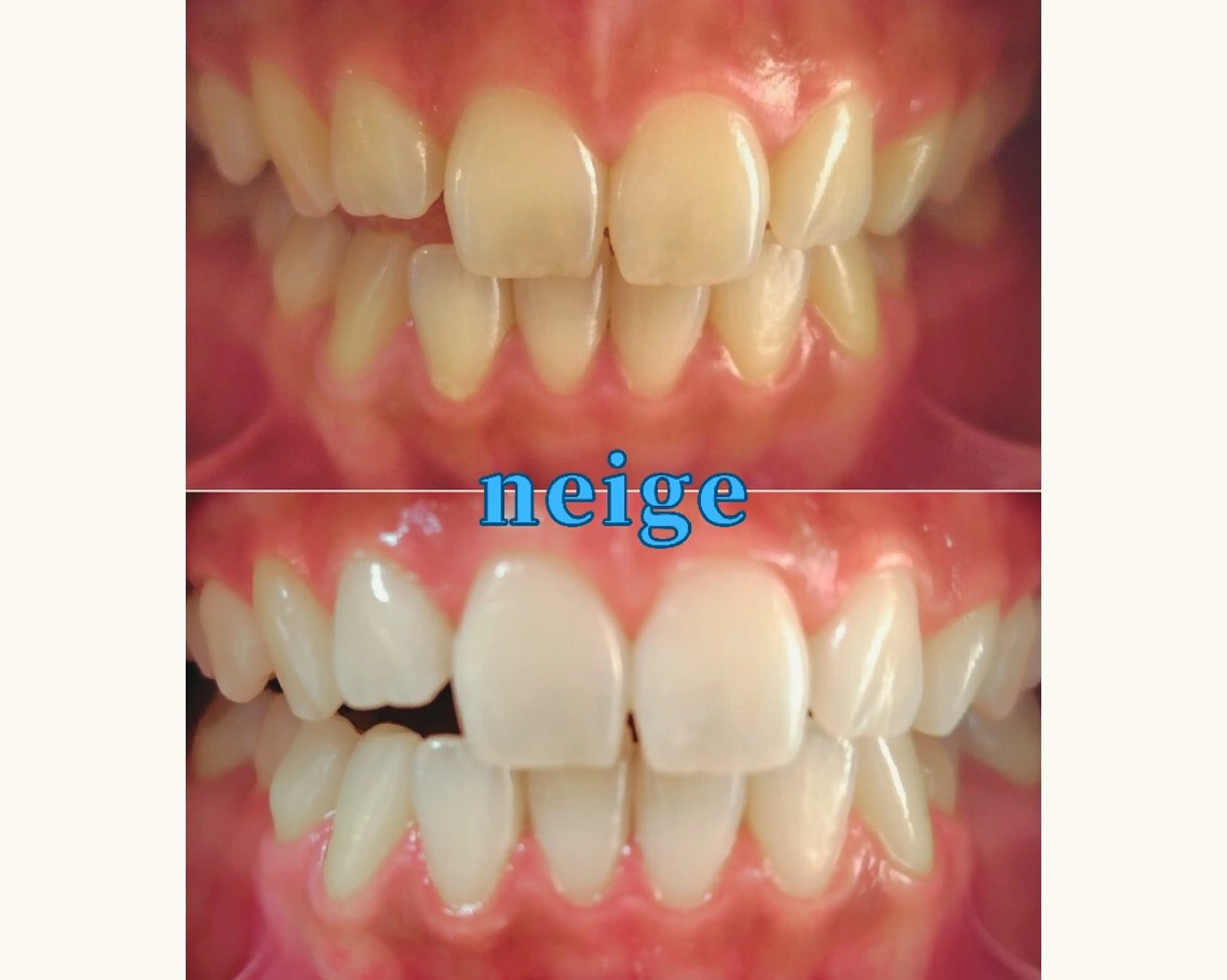 その他 ホワイトニングサロン ネージュ(女性専用)のその他イメージ