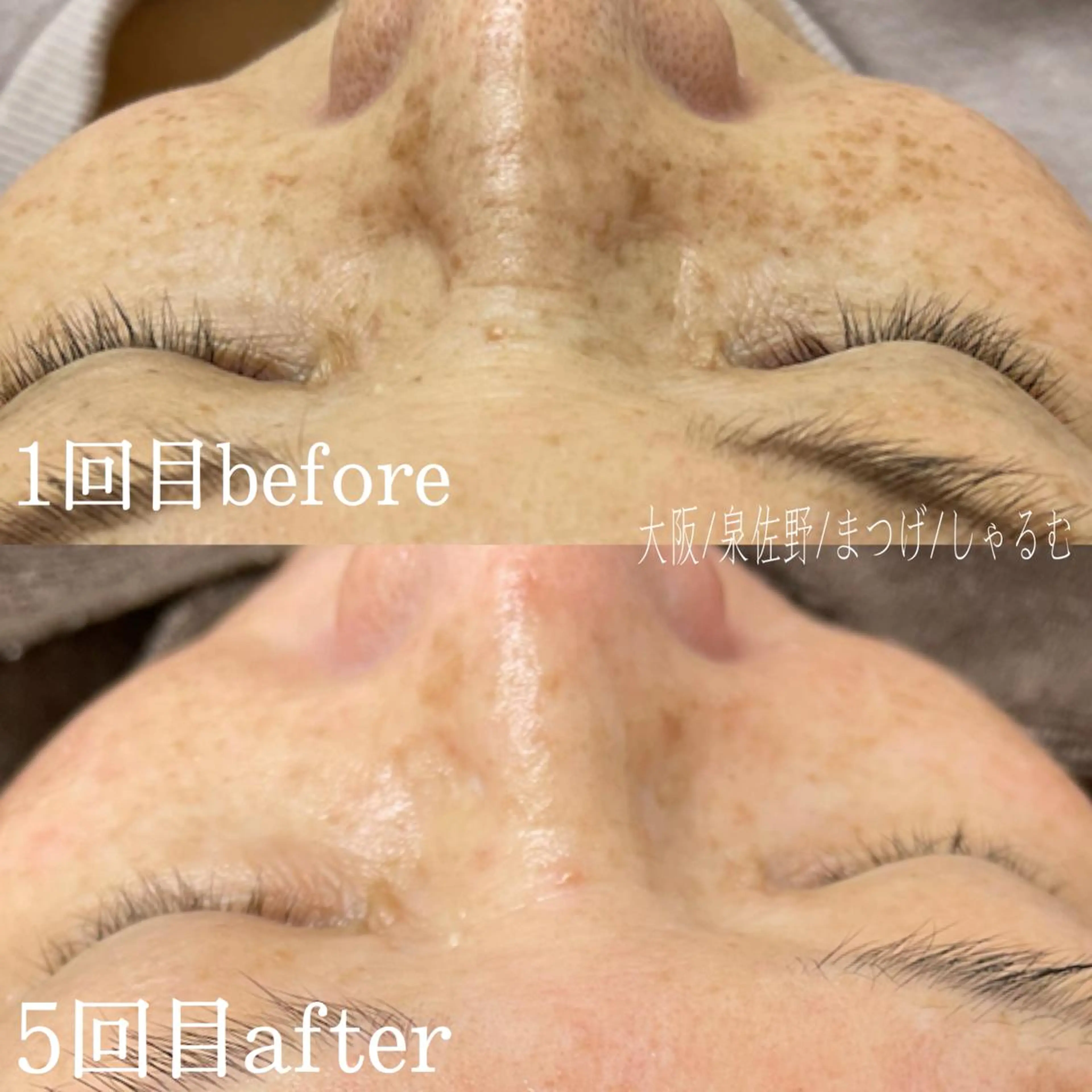 フェイシャルワックスの写真