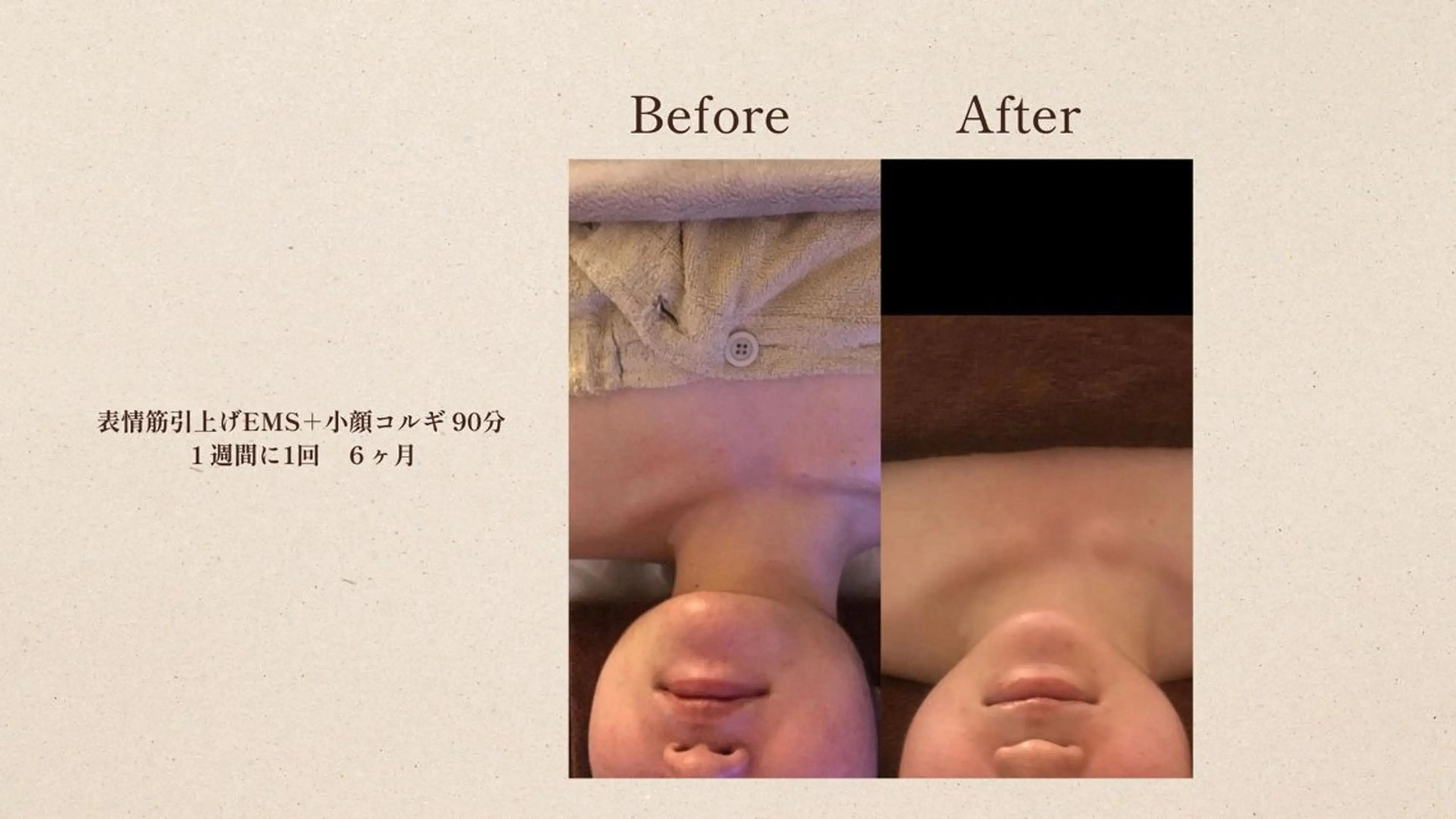 小顔＆美肌 サロンLINKAのエステ・リラクイメージ