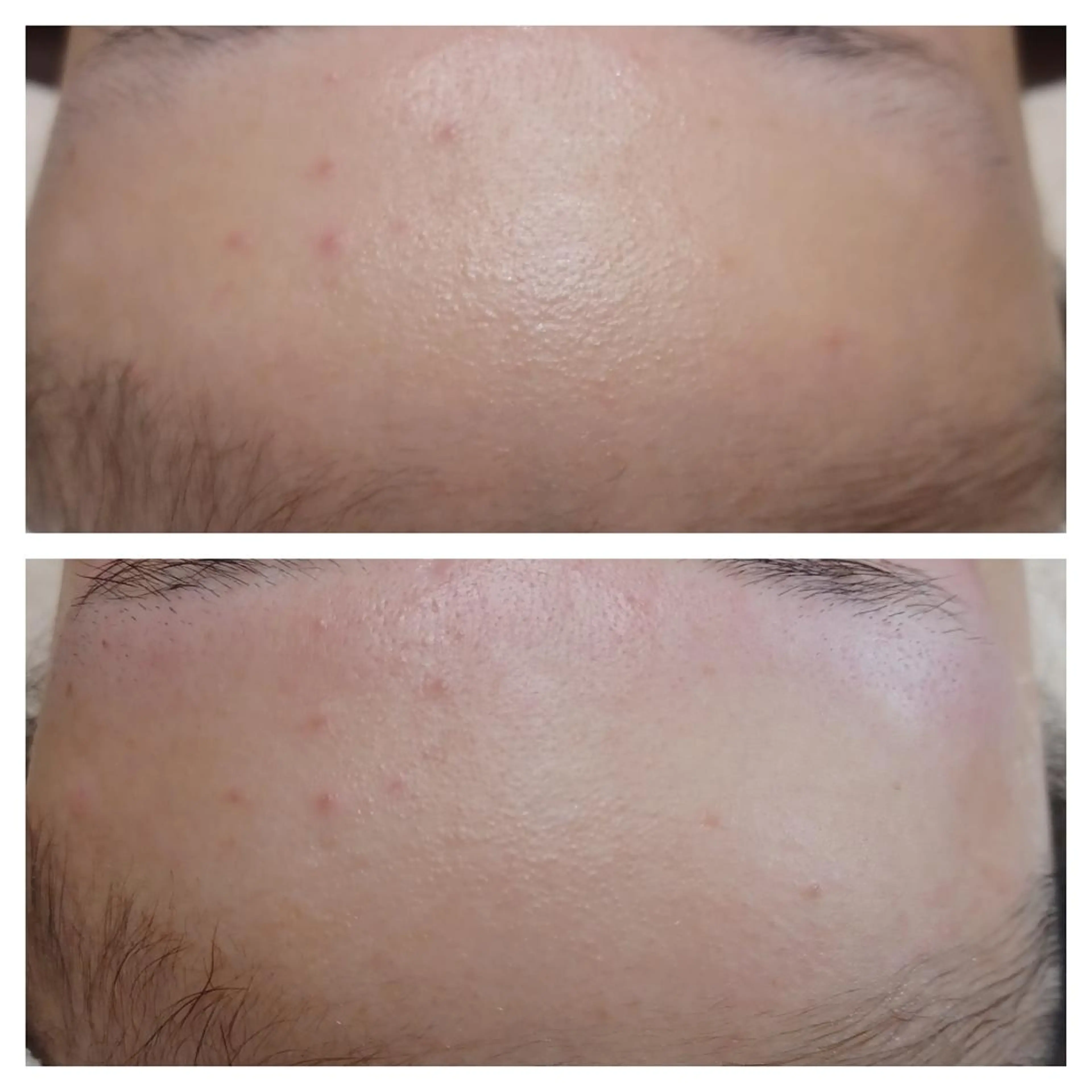 ワックス脱毛専門店 Lutellaのエステ・リラクイメージ