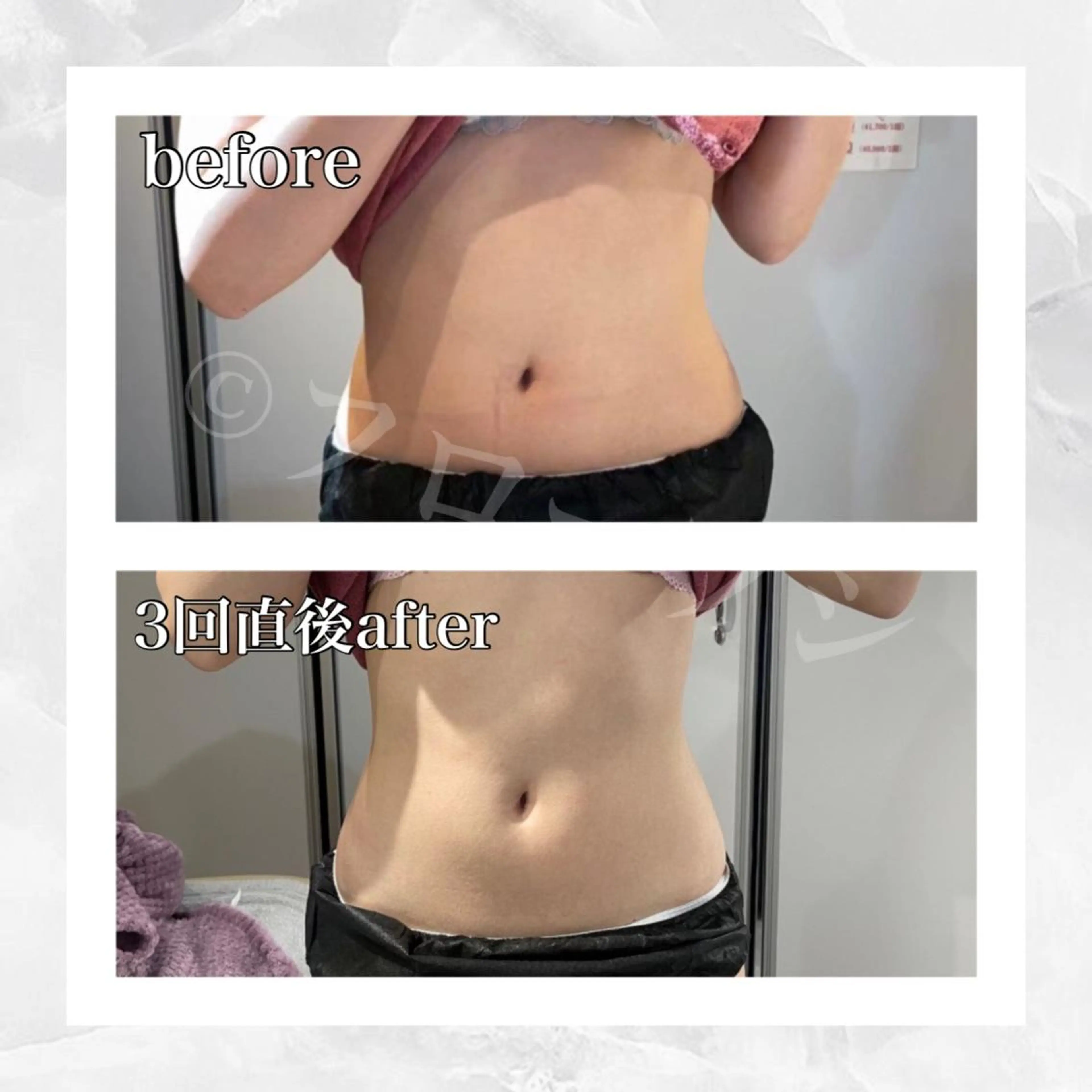 エステ リラク 部分痩せ♥️小顔専門 MIKUのエステ・リラクイメージ