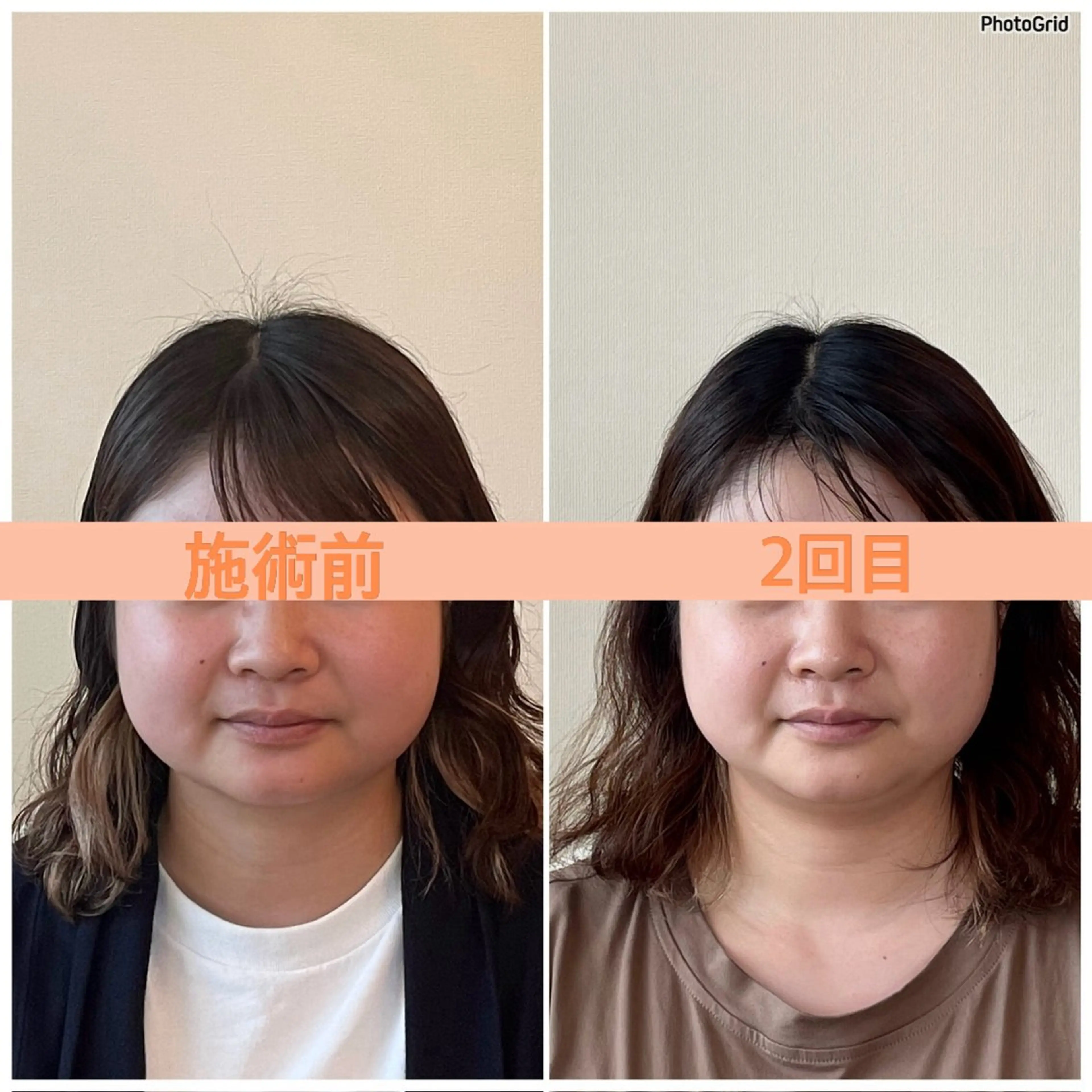 小顔矯正サロン ReFace Fusae(リフェイスフサエ)所属・小顔矯正サロン リフェイスフサエのエステ・リラクイメージ