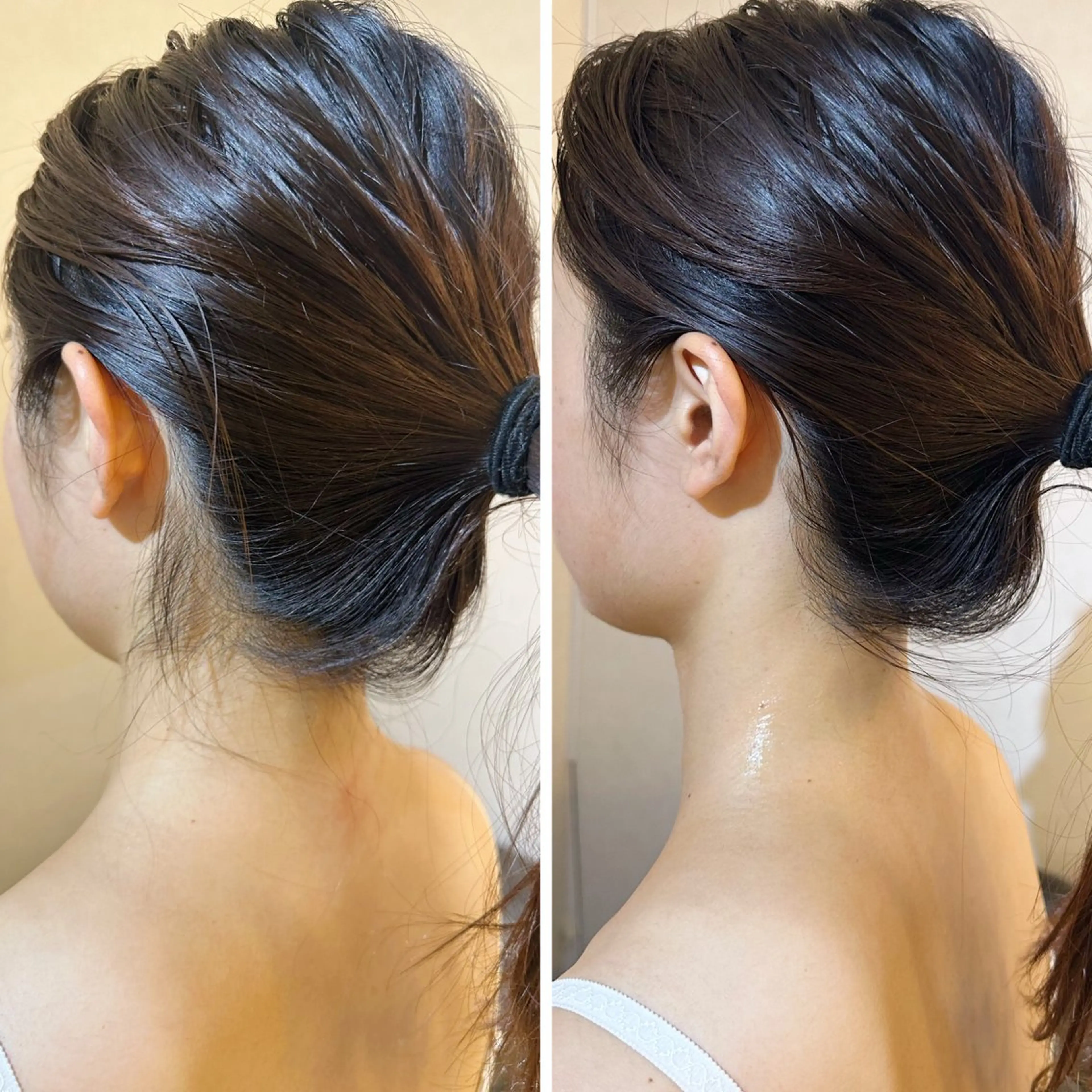 脱毛 うなじ脱毛/美肌脱毛 LABELのエステ・リラクイメージ