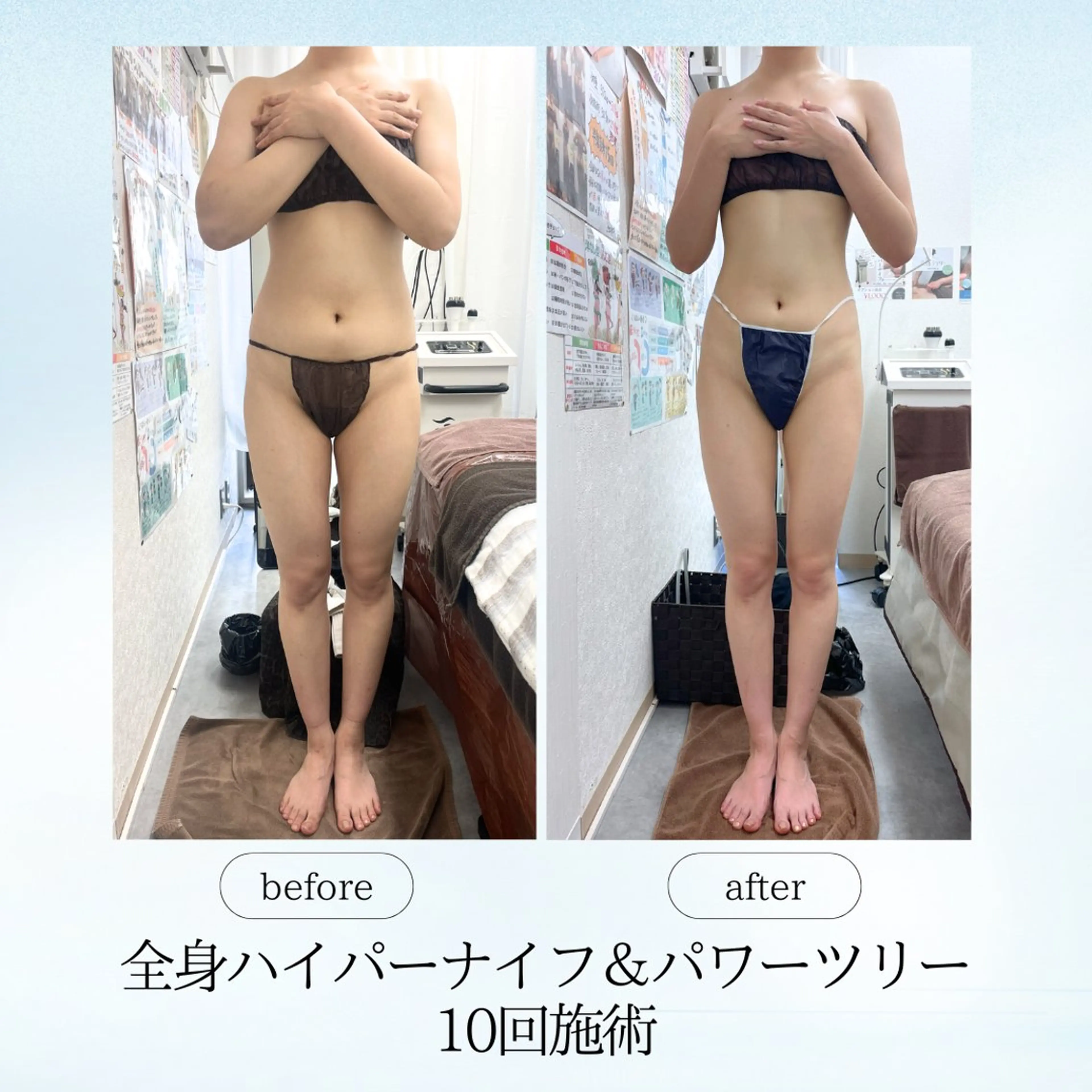 エステ リラク 《痩身、小顔専門店》 エスプレッソのエステ・リラクイメージ