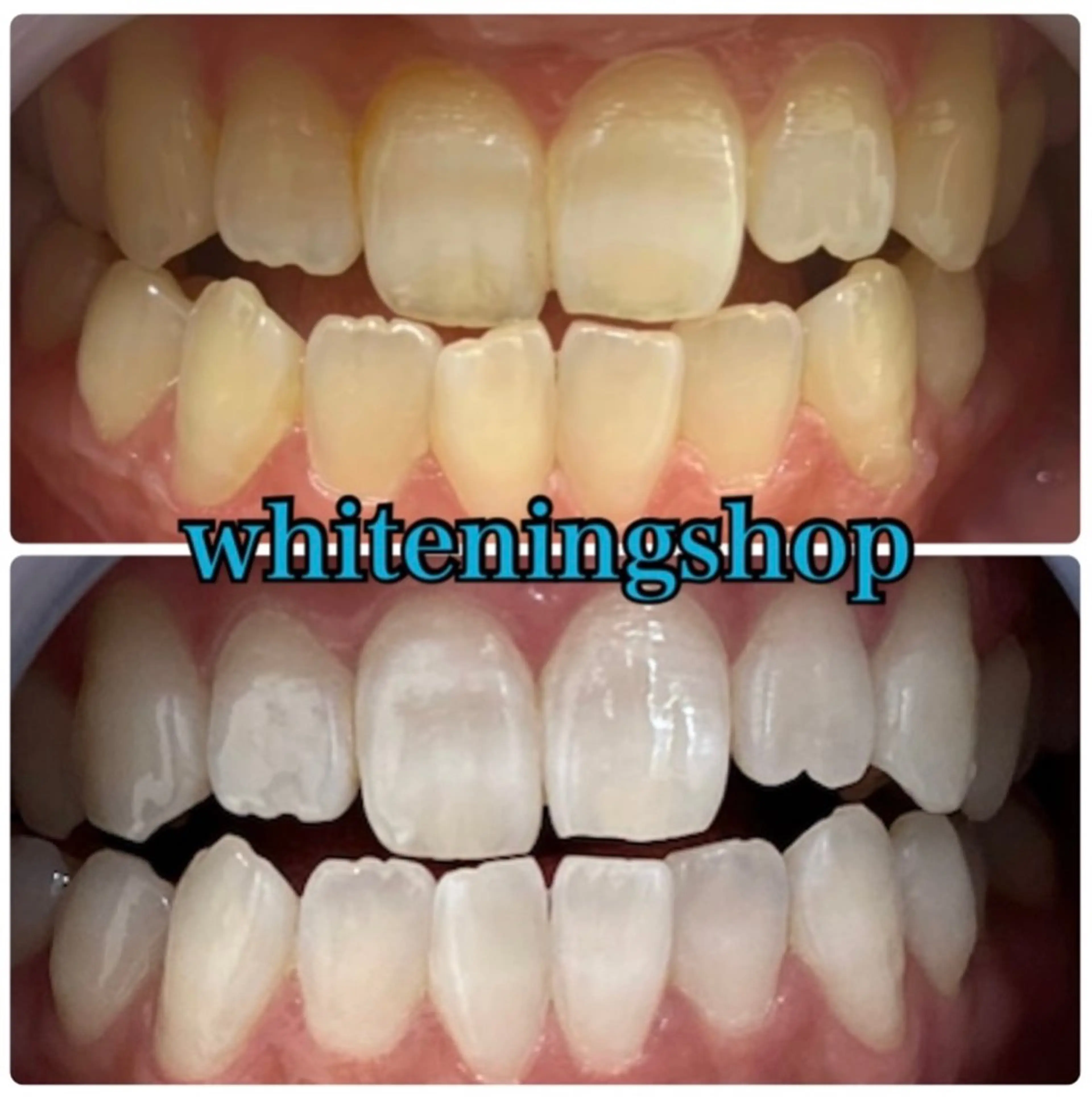 エステ リラク ホワイトニング ショップ吉祥寺店のエステ・リラクイメージ