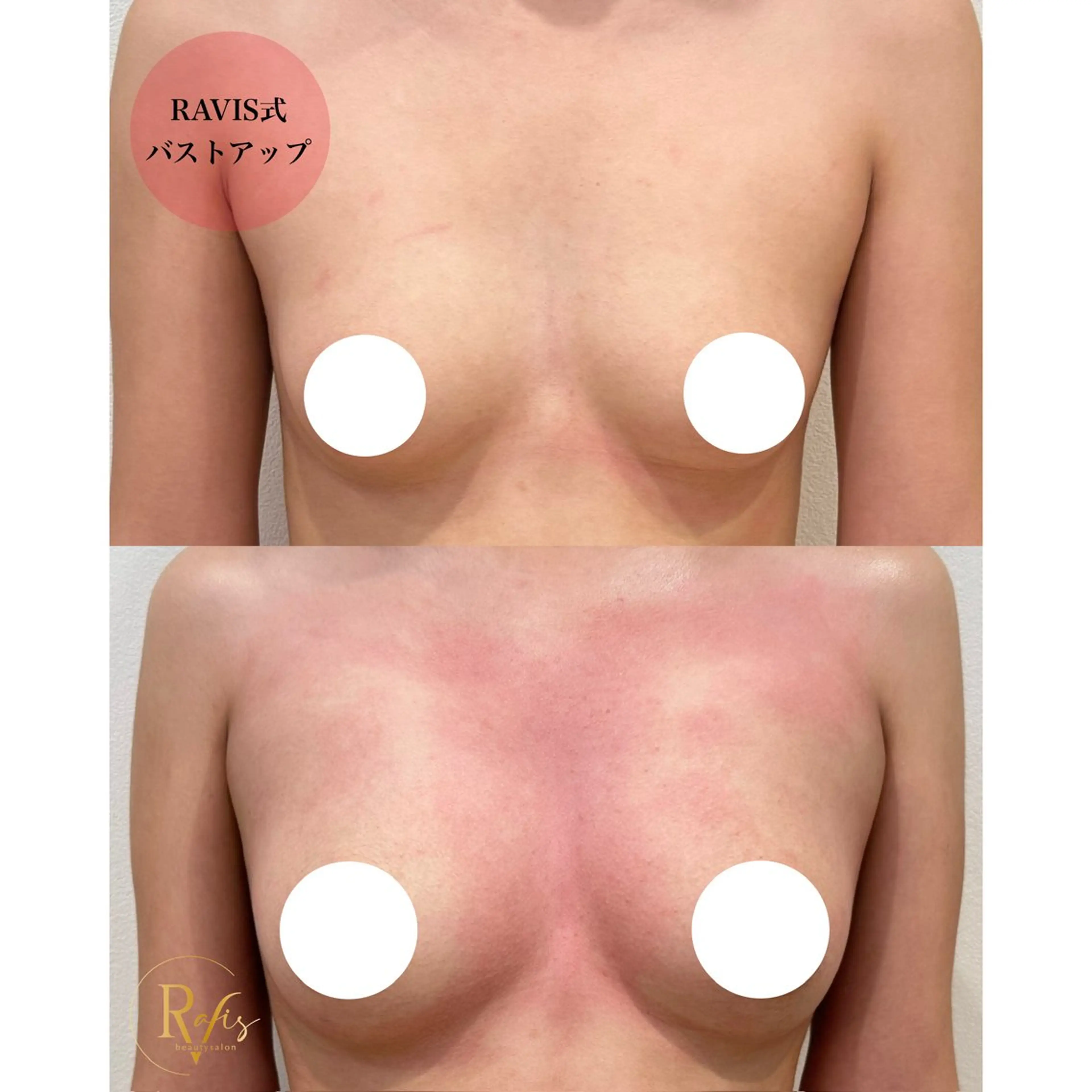 エステ 東大阪/韓国肌管理/ 痩身バスト専門店のエステ・リラクイメージ