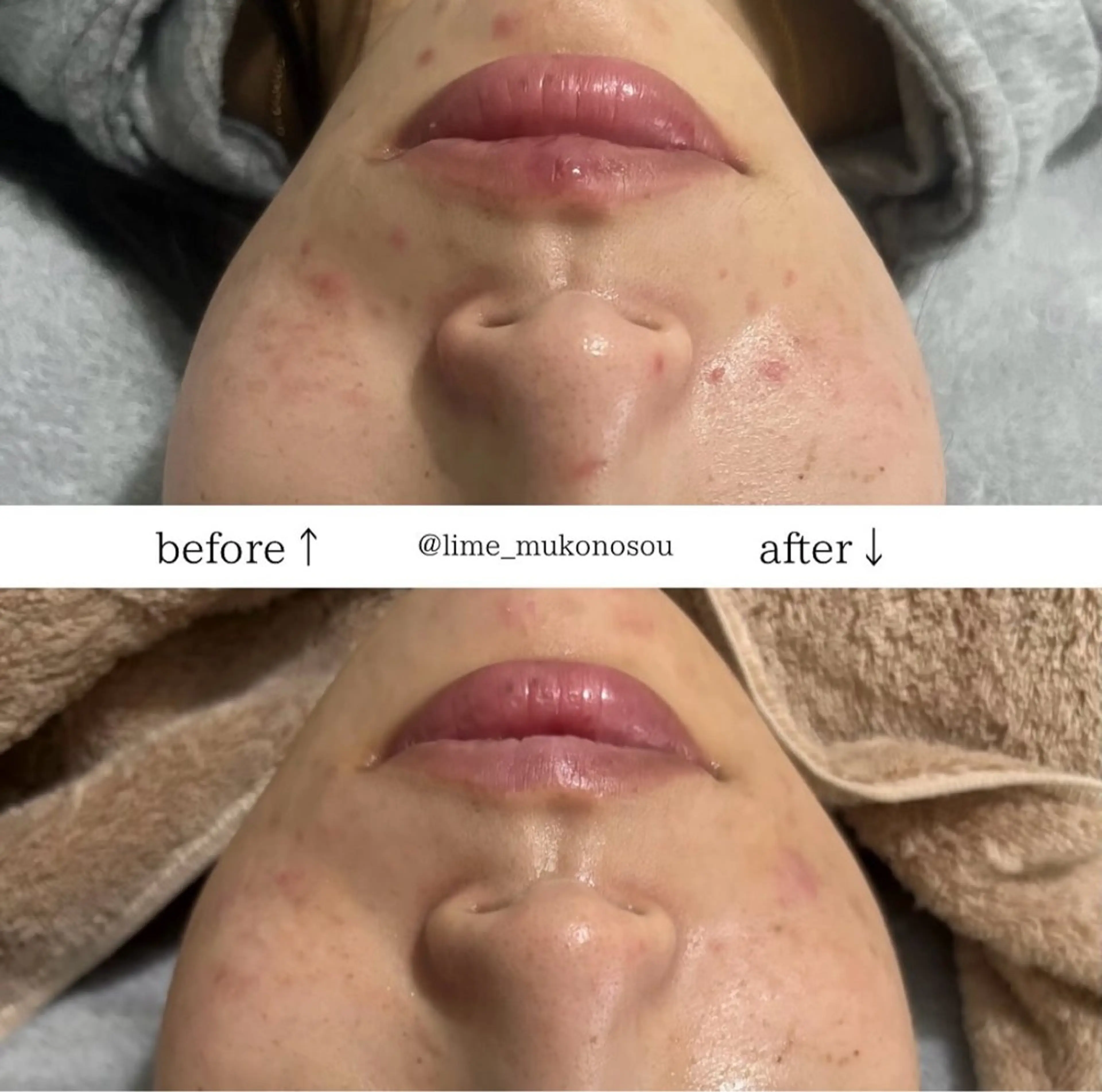 LIME 武庫之荘店のエステ・リラクイメージ