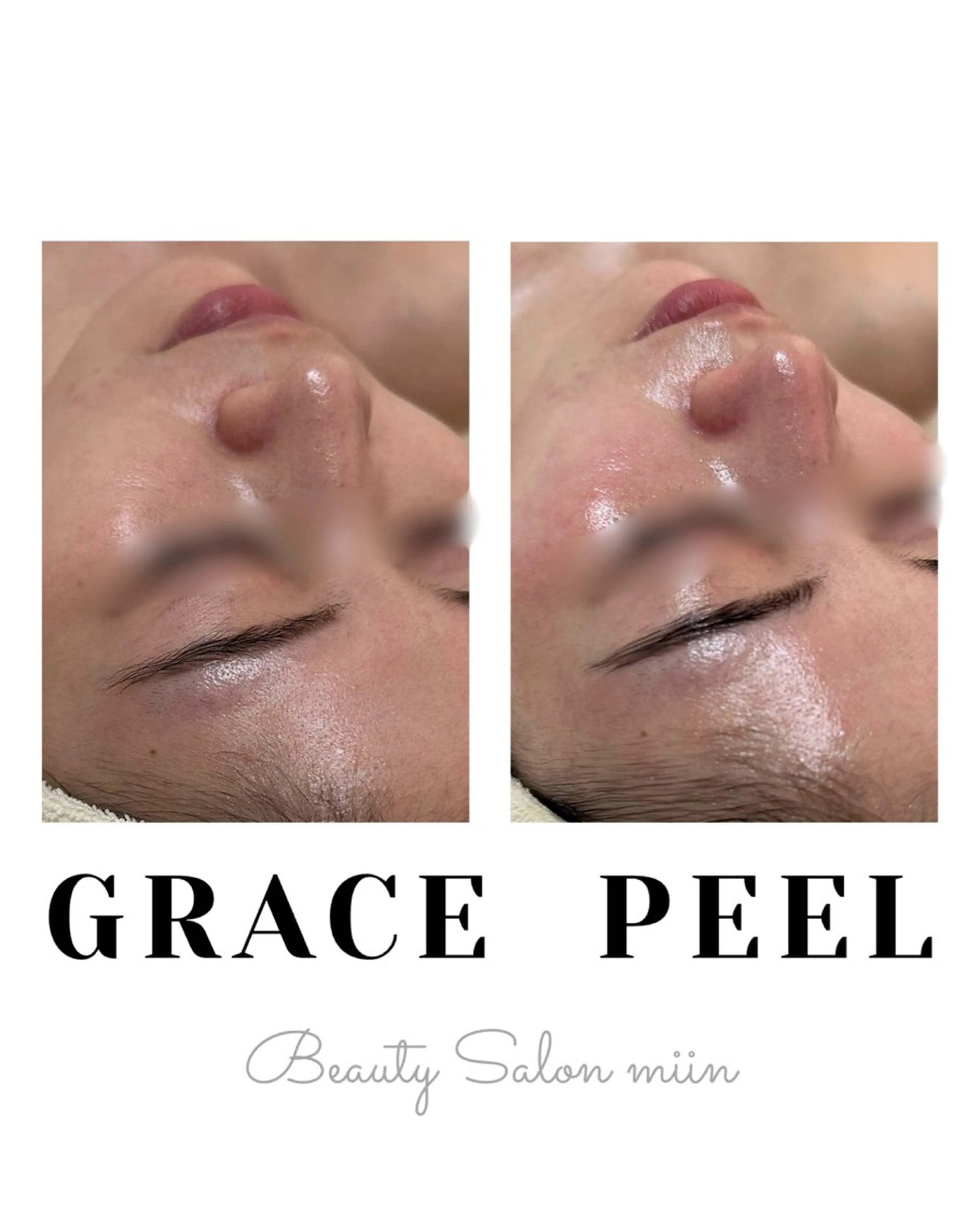 エステ 韓国肌管理 白玉肌管理®︎のエステ・リラクイメージ