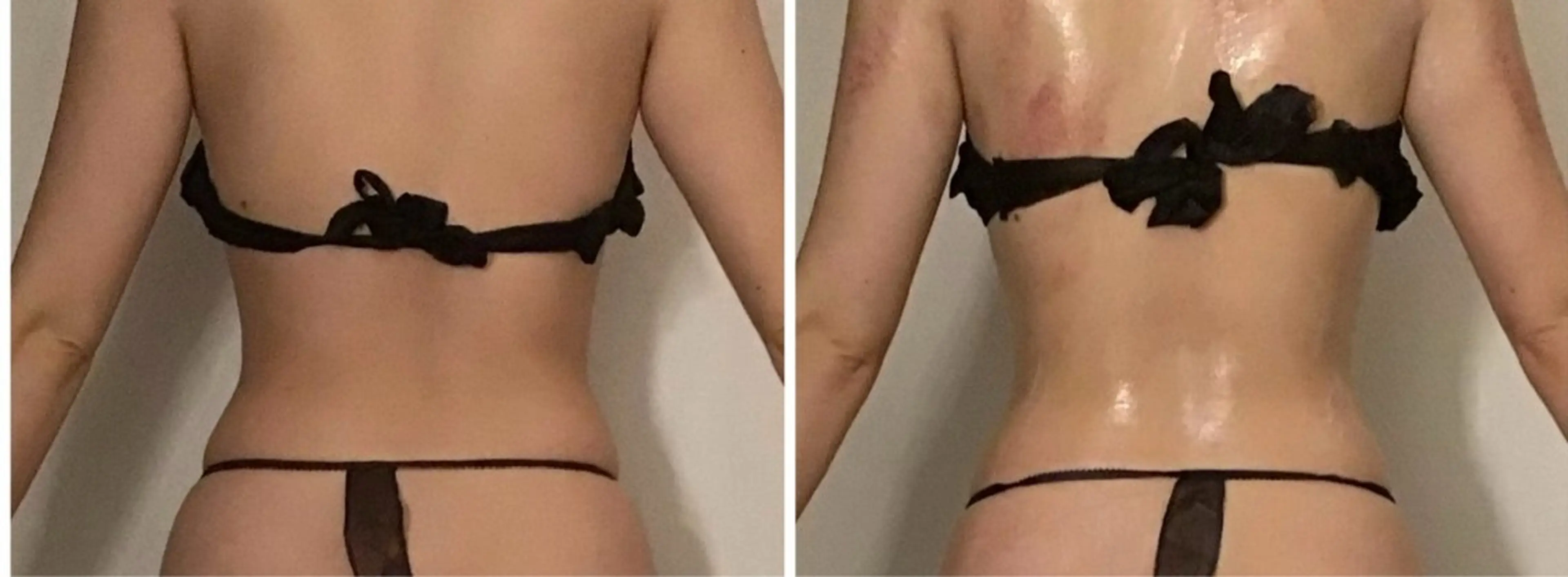 エステ リラク BELLEFINE 💕痩身・小顔・脱毛のエステ・リラクイメージ