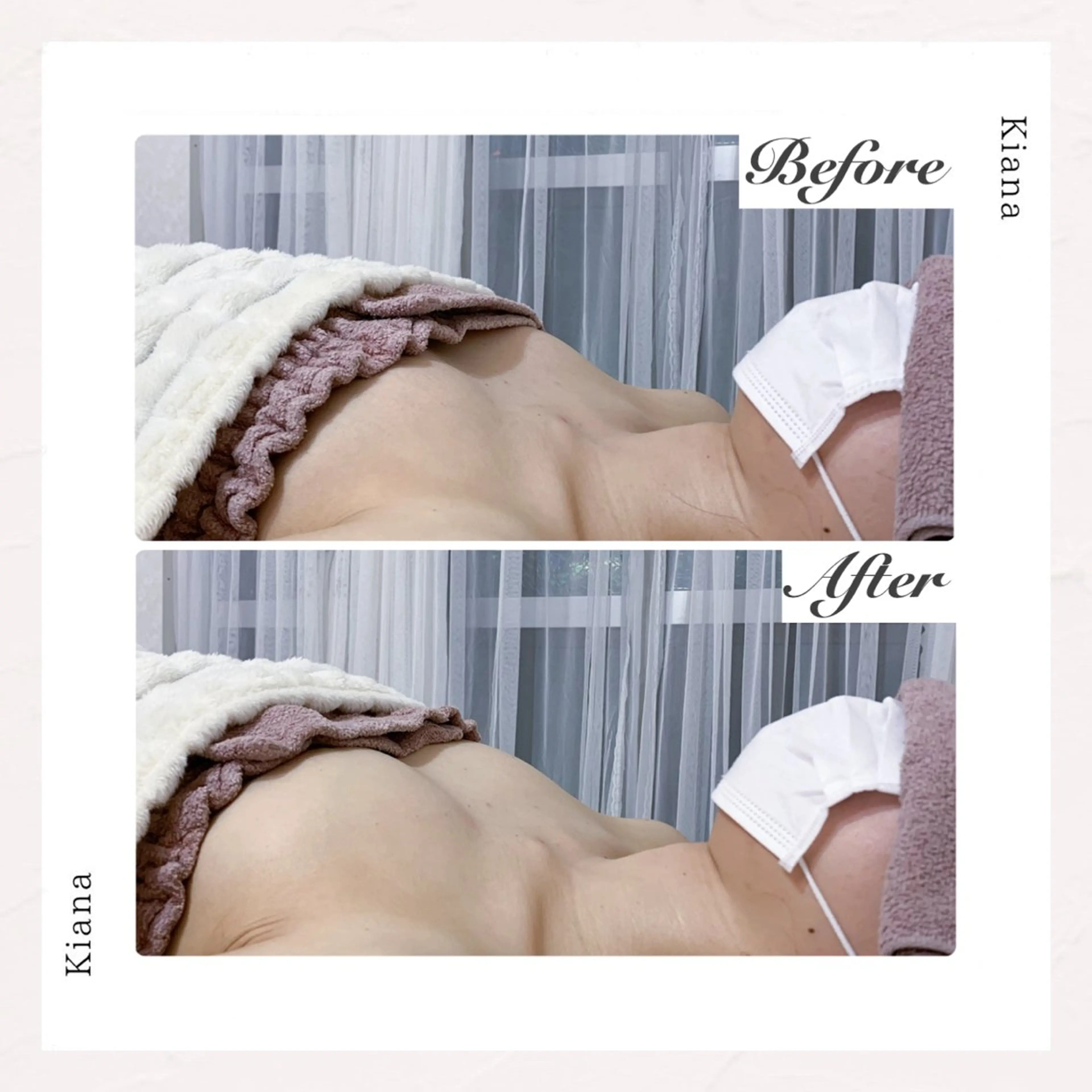 バスト専門Kiana 風のエステ・リラクイメージ