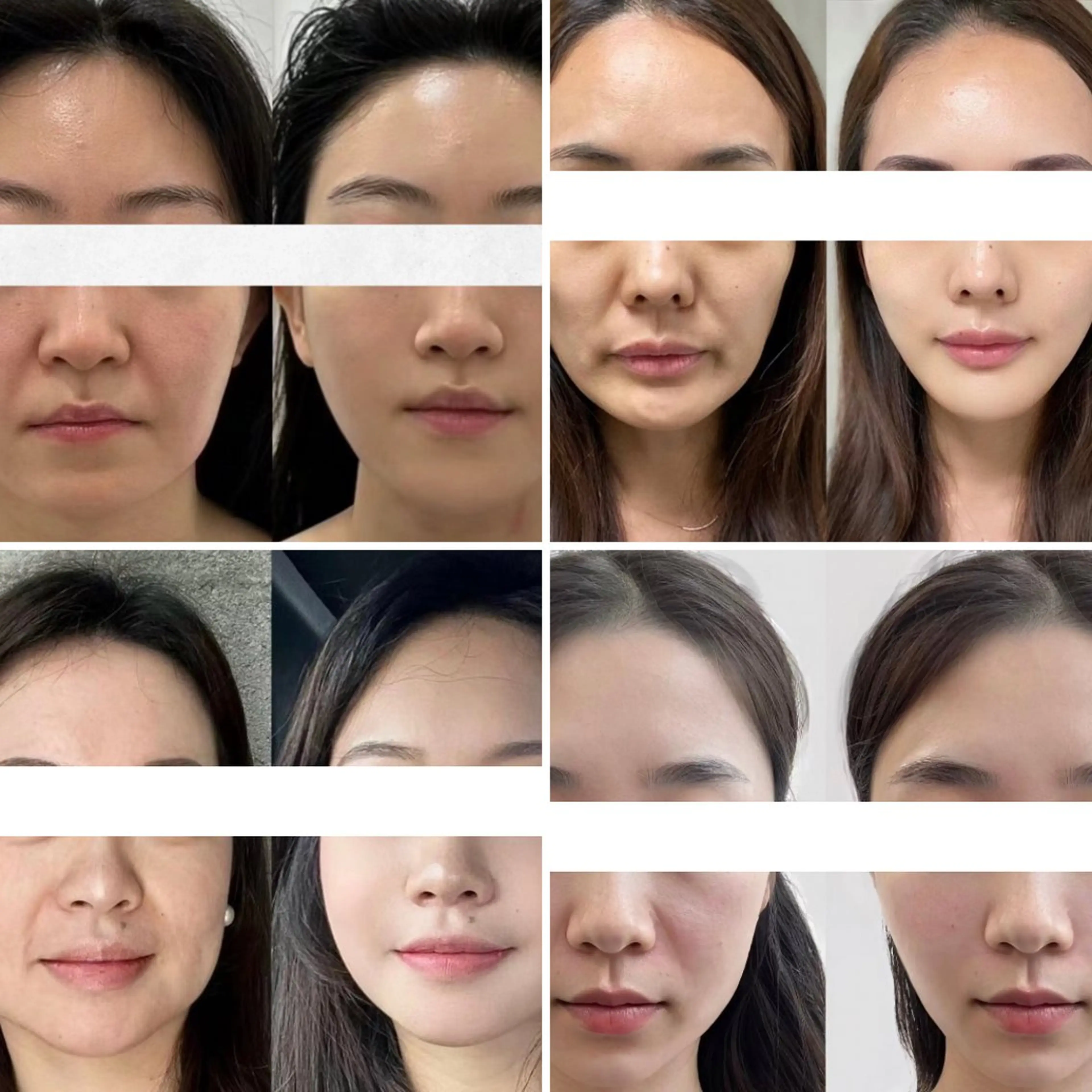 エステ リラク 愛維美水光美肌専門店所属・愛維美水光美肌専門店 メンズレディースokのエステ・リラクイメージ